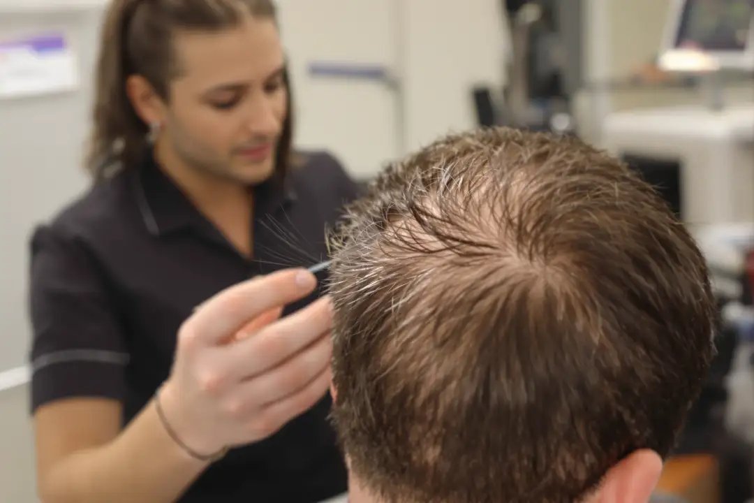 FUE Hair Transplant: How It Works vs DHI