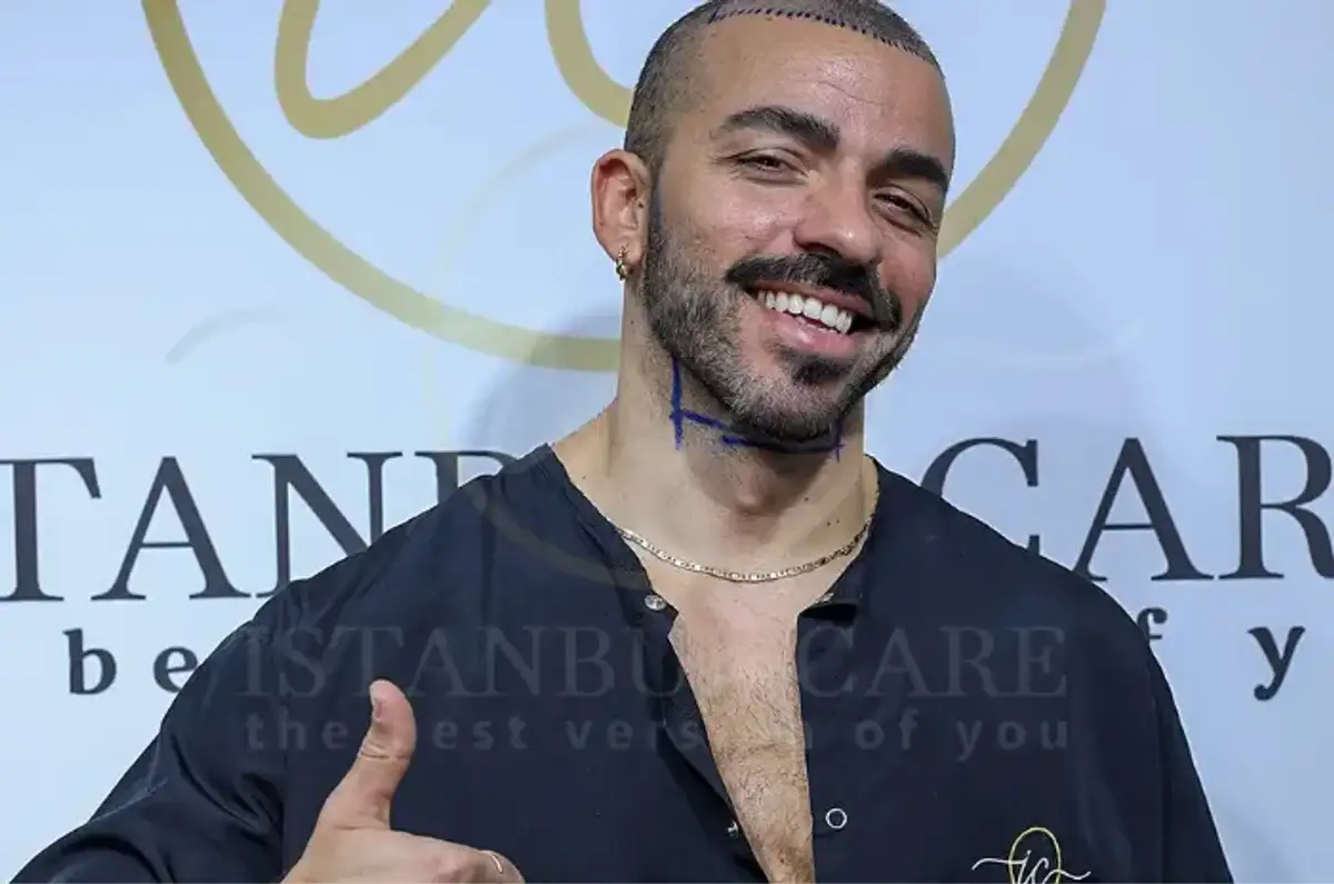 istanbul-care-hair transplant-like