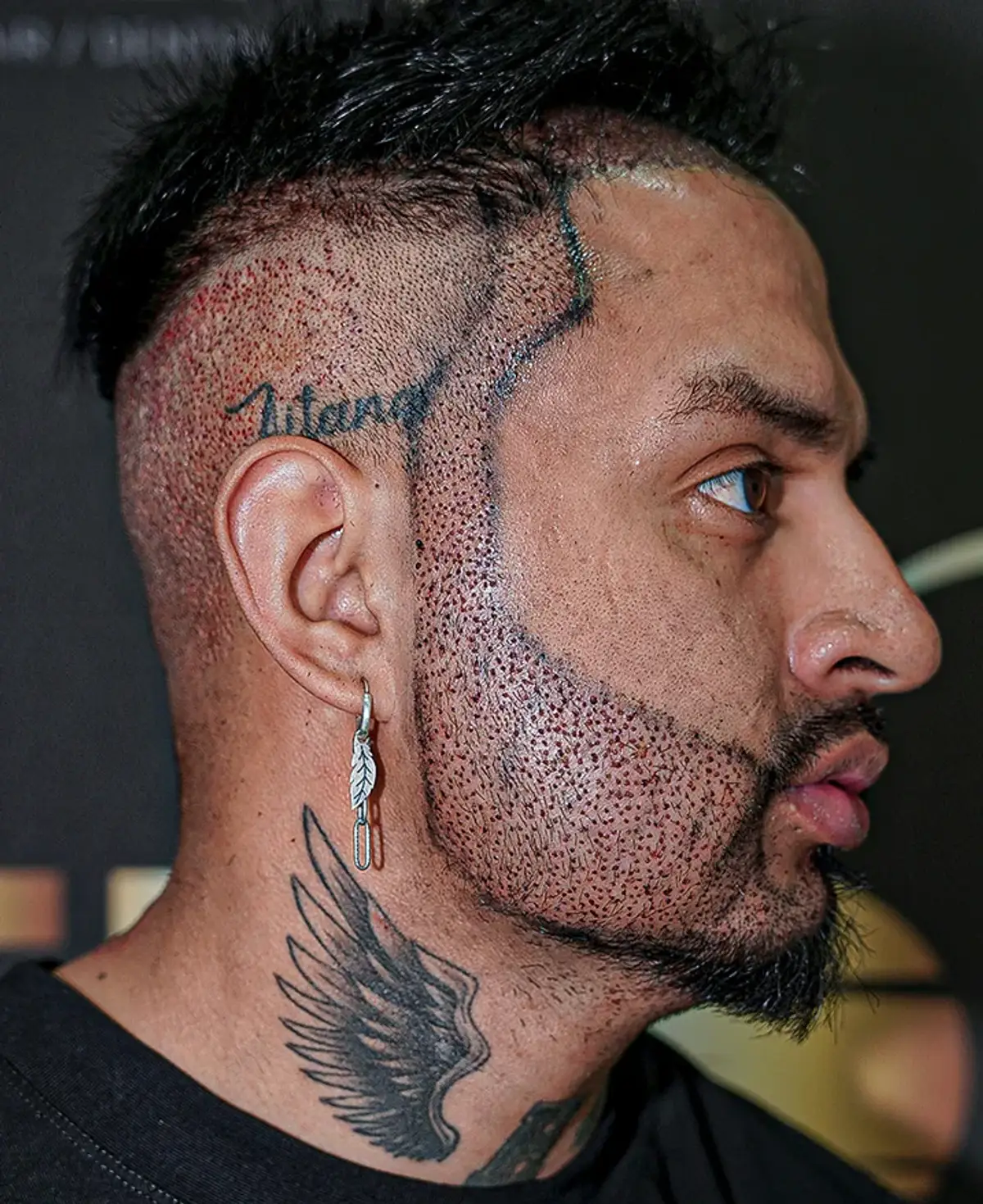 donor-hair-options-from-scalp.jpg