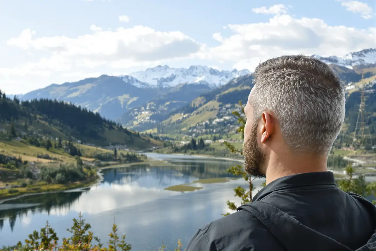 Ultimate Guide to FUT Hair Transplant Procedure
