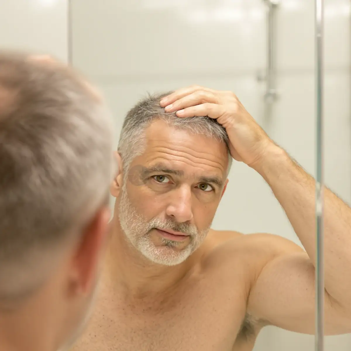 Uomo che controlla i suoi capelli diradati allo specchio prima di iniziare la terapia con luce rossa per la crescita dei capelli