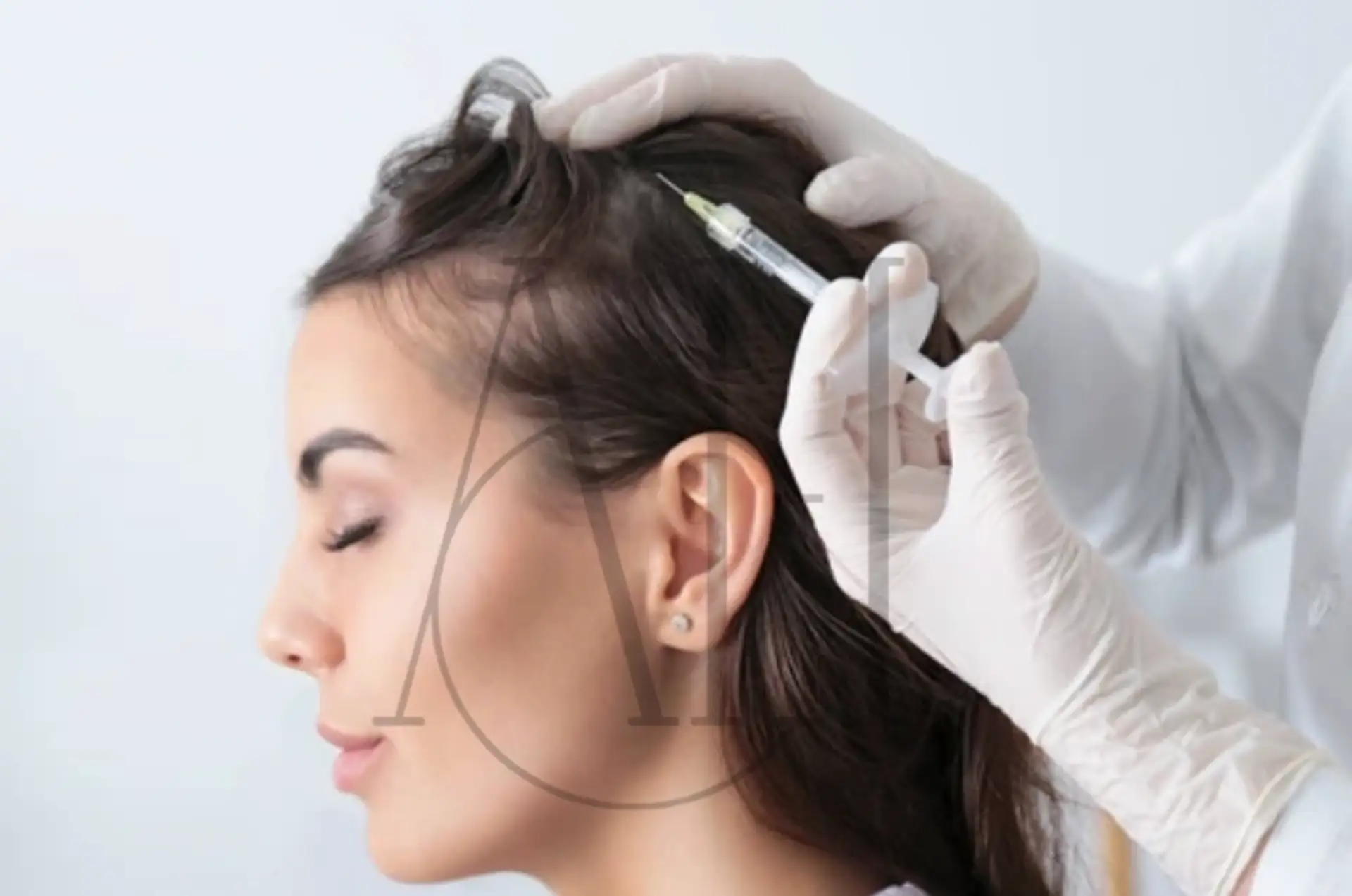 gene therapy for hair loss