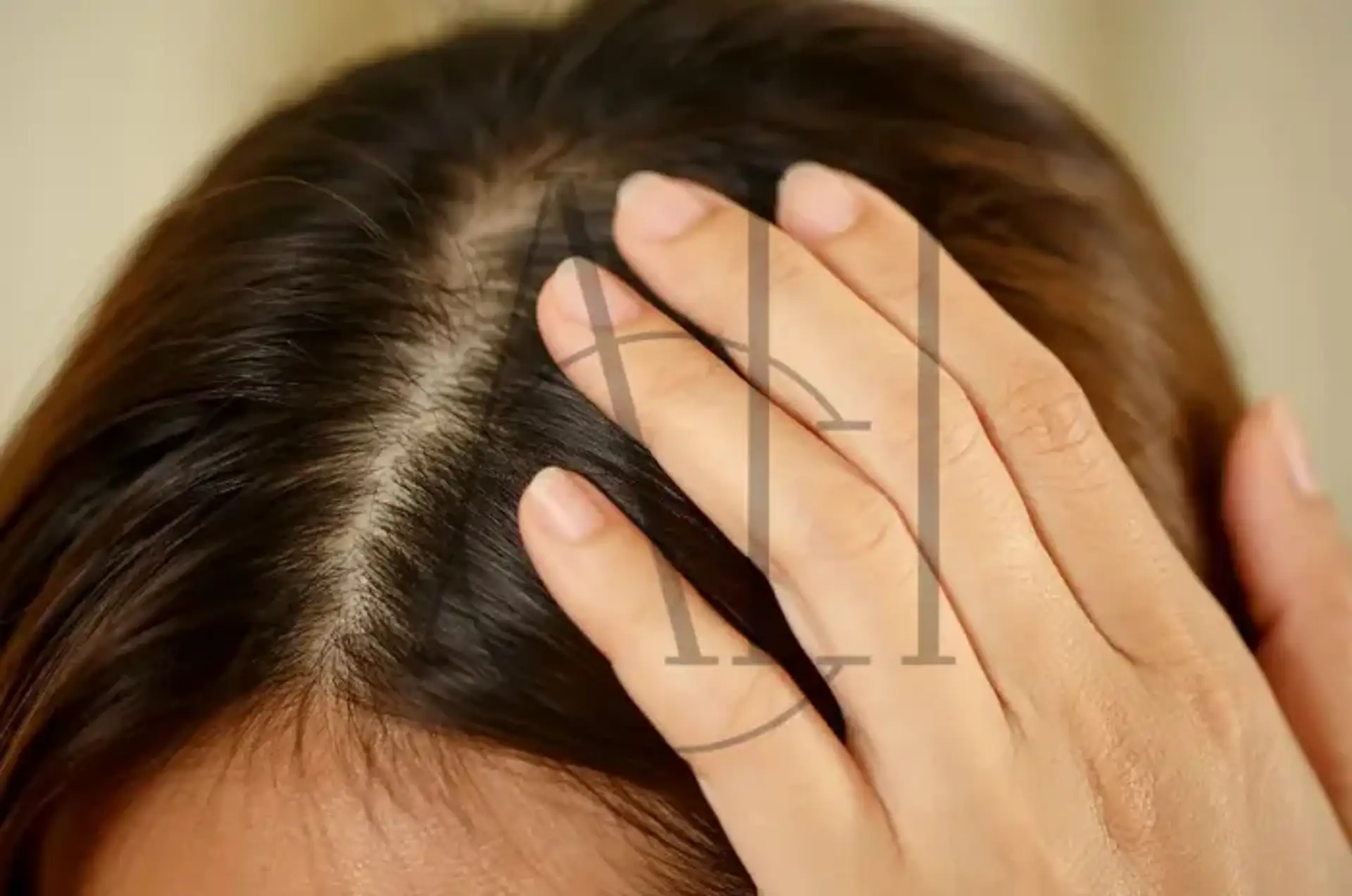 Dry Scalp Medications Remedies