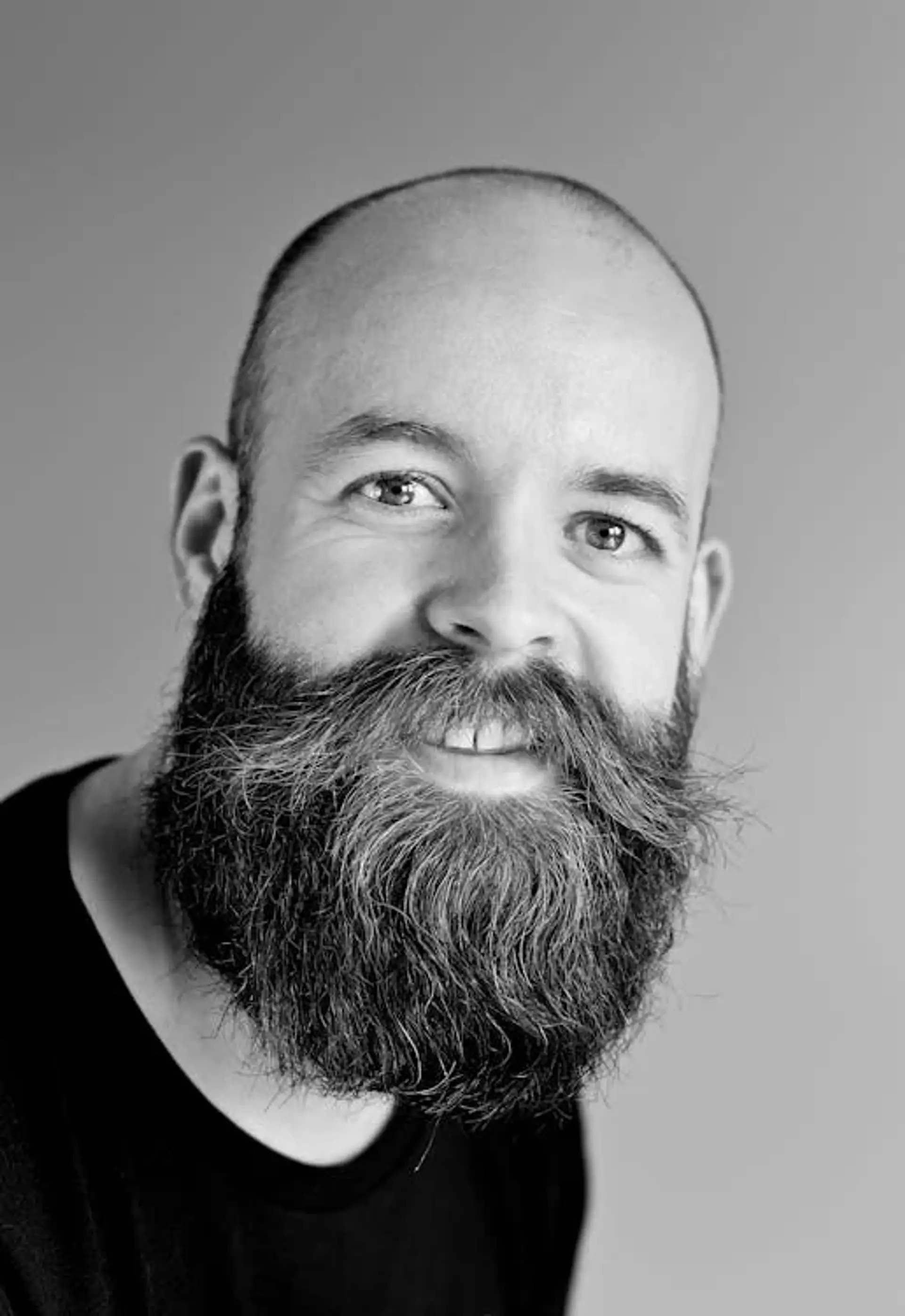 Trasforma il tuo aspetto con un trapianto di barba in Albania
