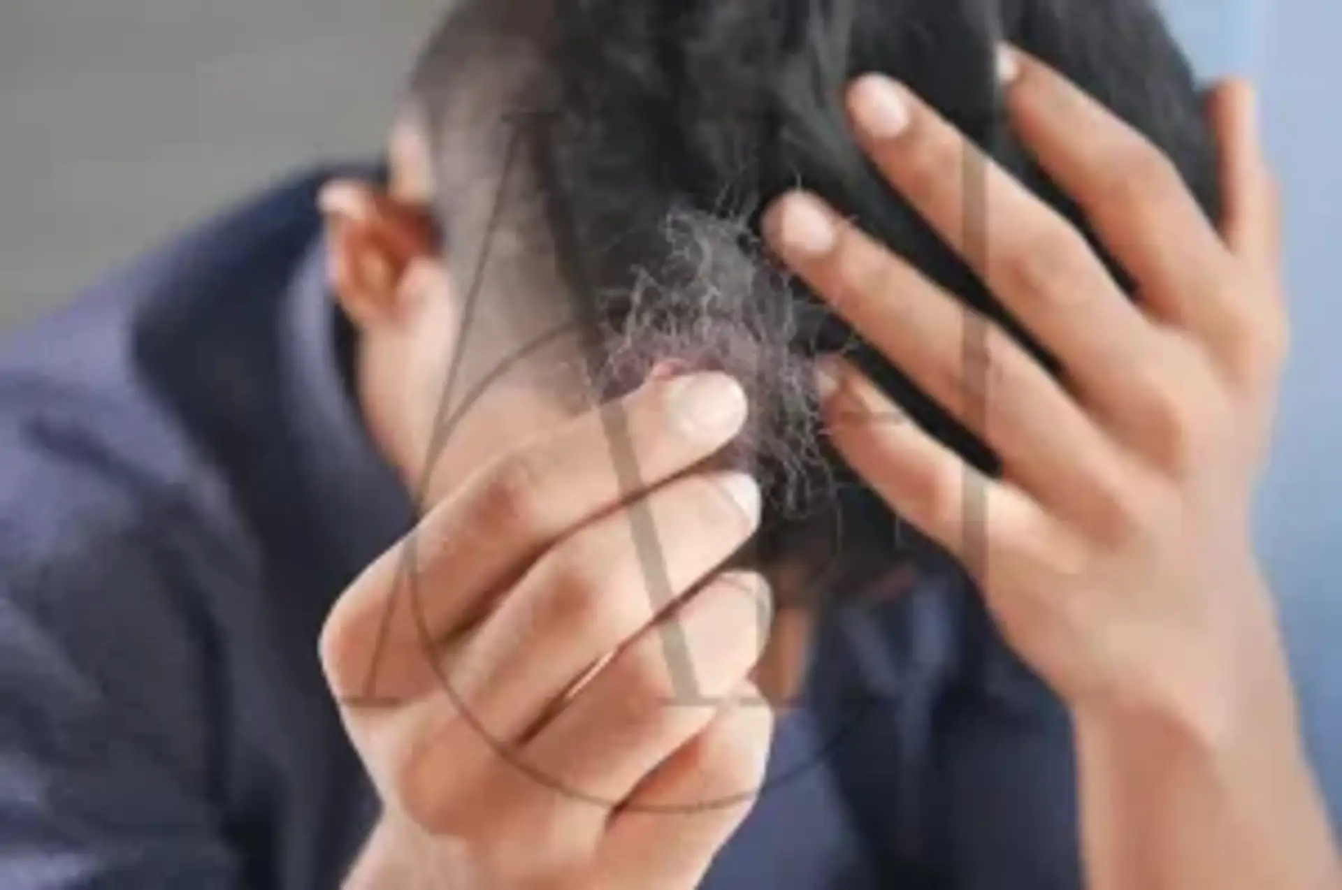 Consulenza efficace dei pazienti con perdita di capelli