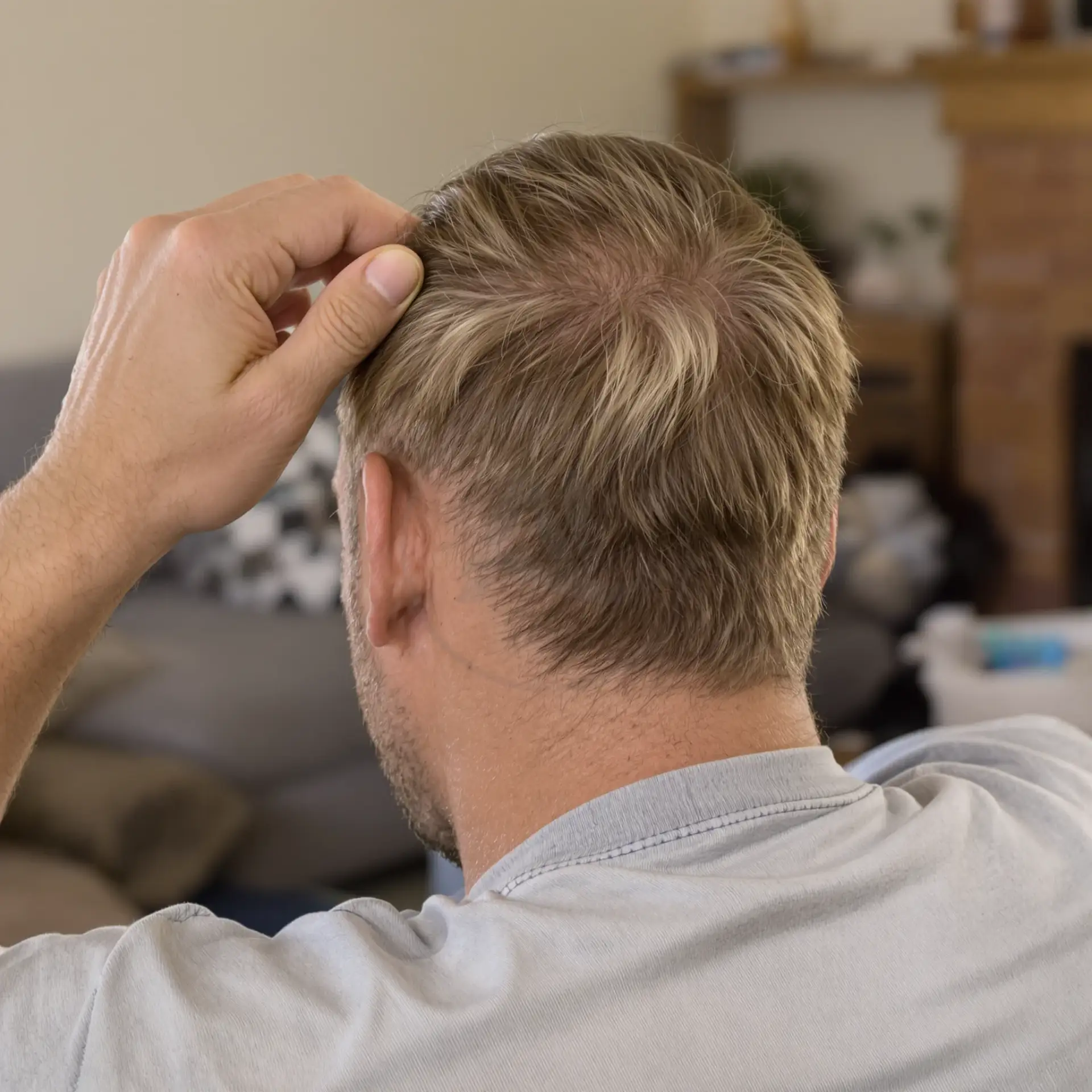 Back view of a man touching the top of his thinning blond hair