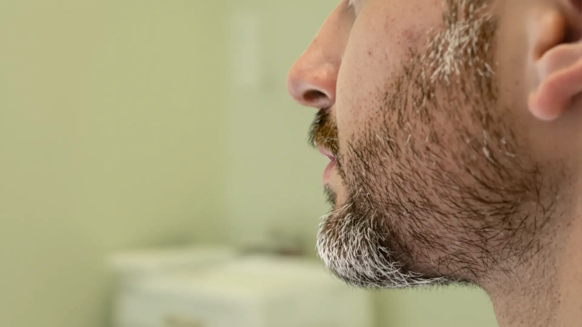 Trapianto Barba Rischi e Cicatrici: Costo, Procedura e Risultati