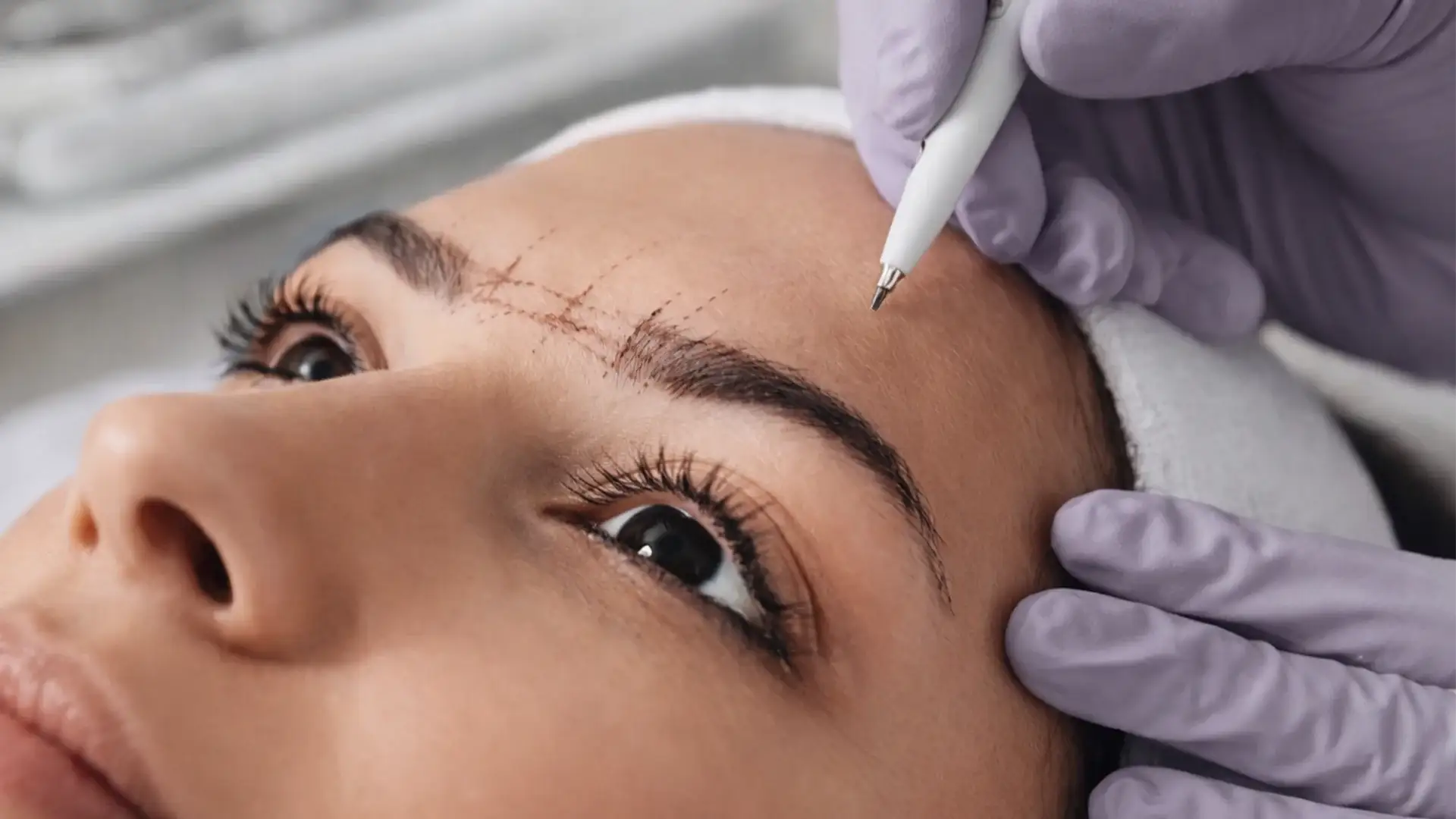 eyebrow-transplant