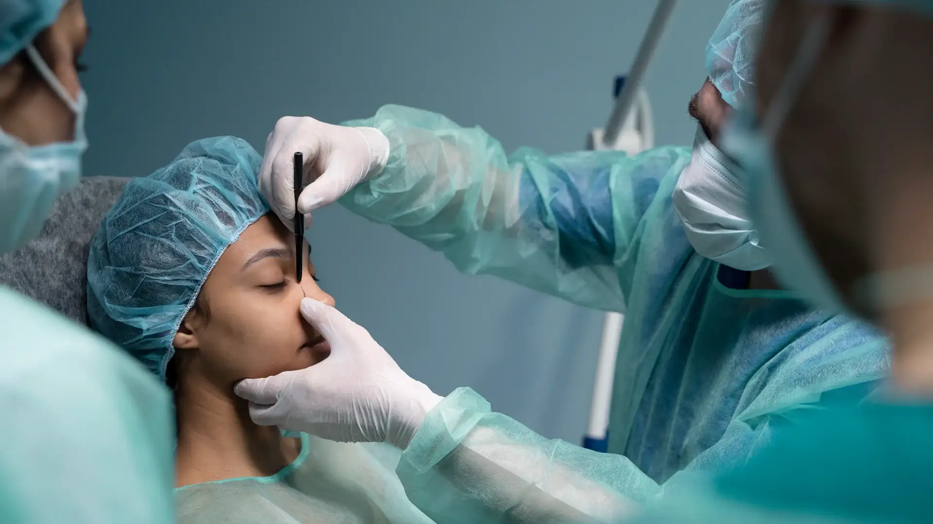 nose-surgery-results-turkey