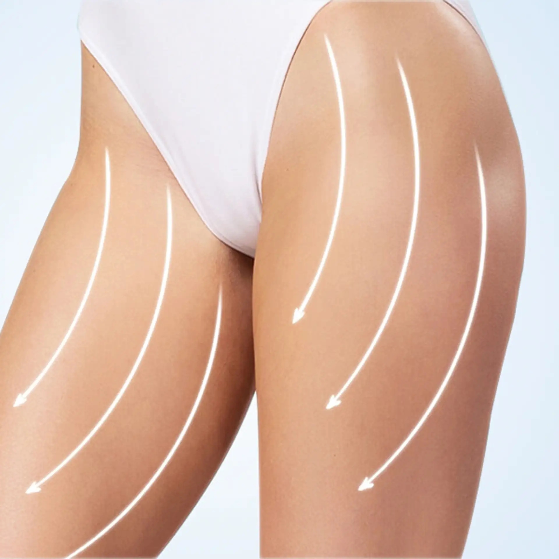 what-is-thigh-lift-surgery-turkey