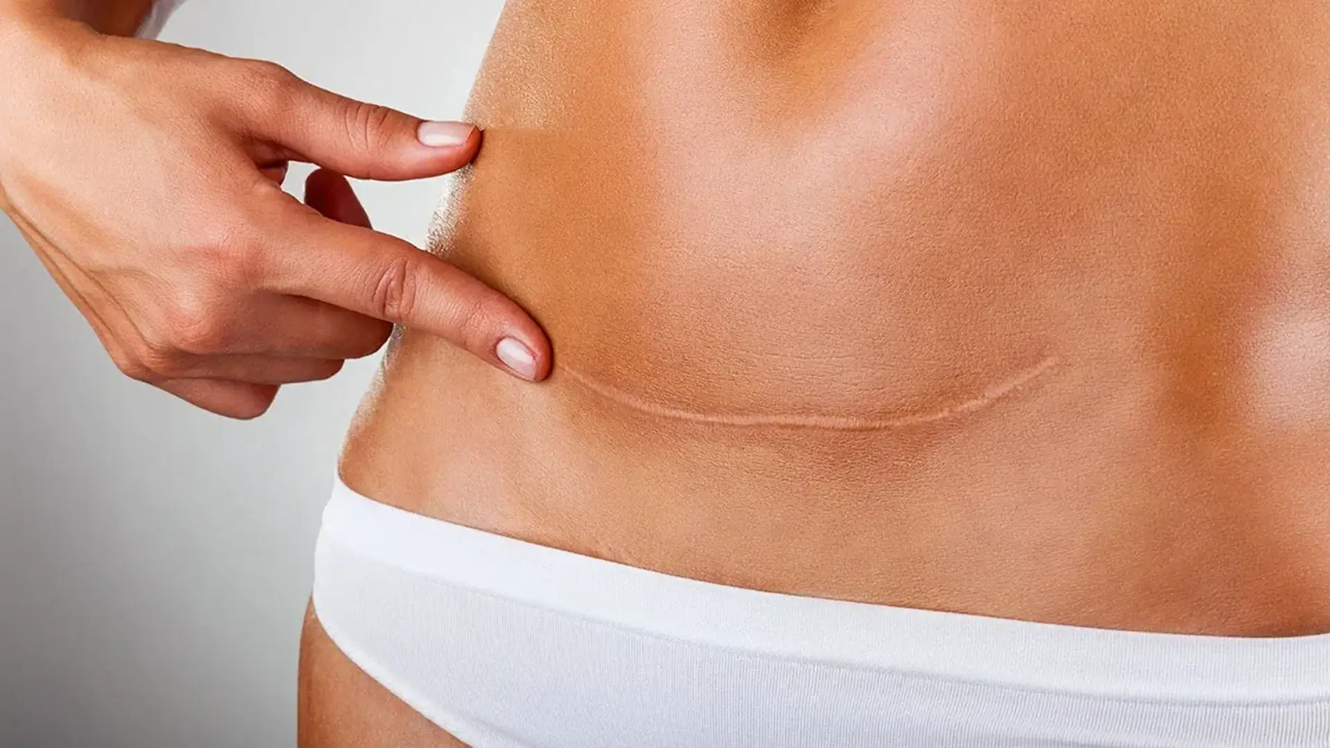 how-long-does-tummy-tuck-surgery-take