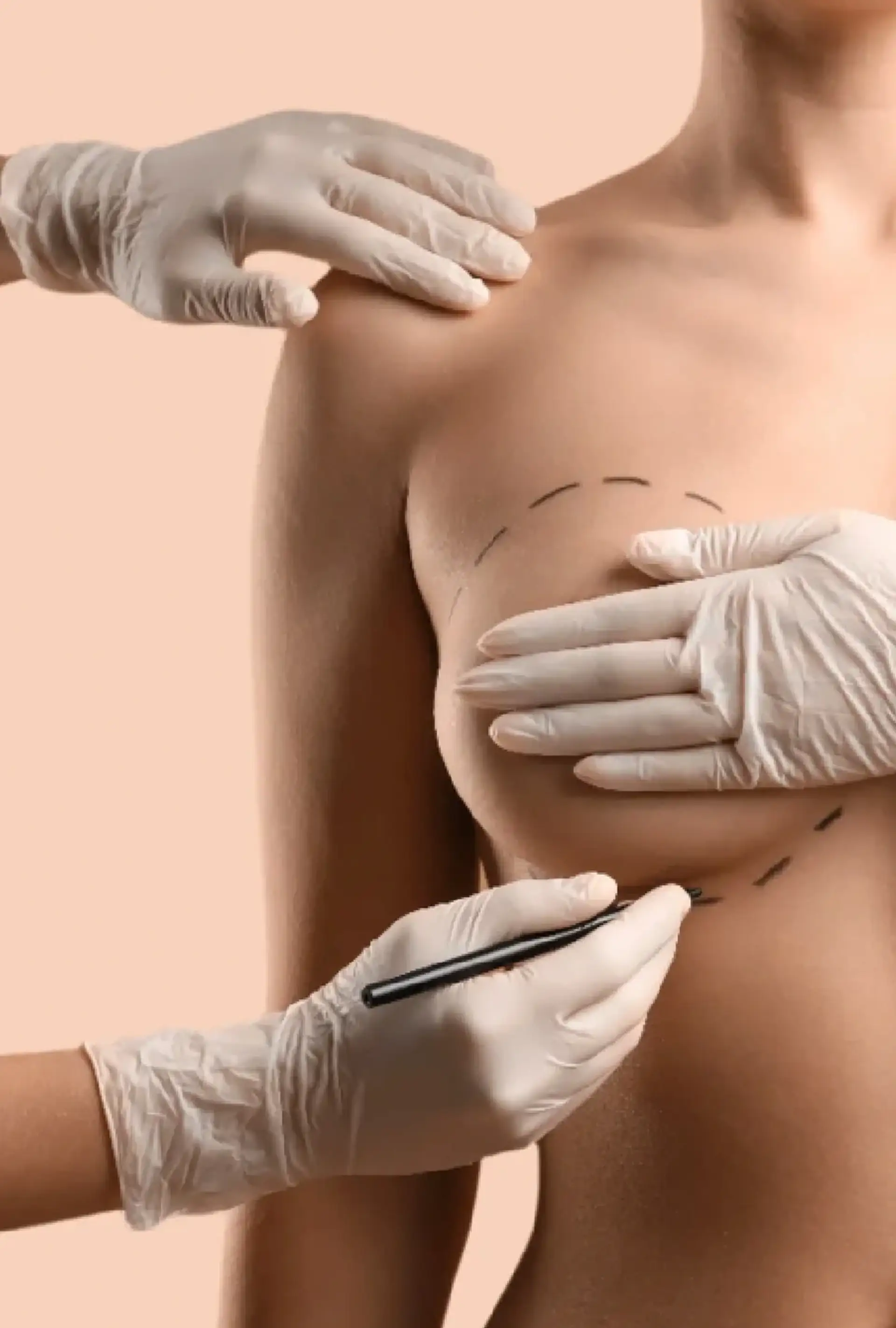 Breast Enlargement in Turkey