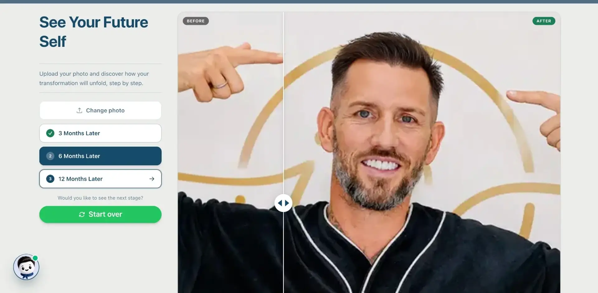 Hair transplant before and after projection tool