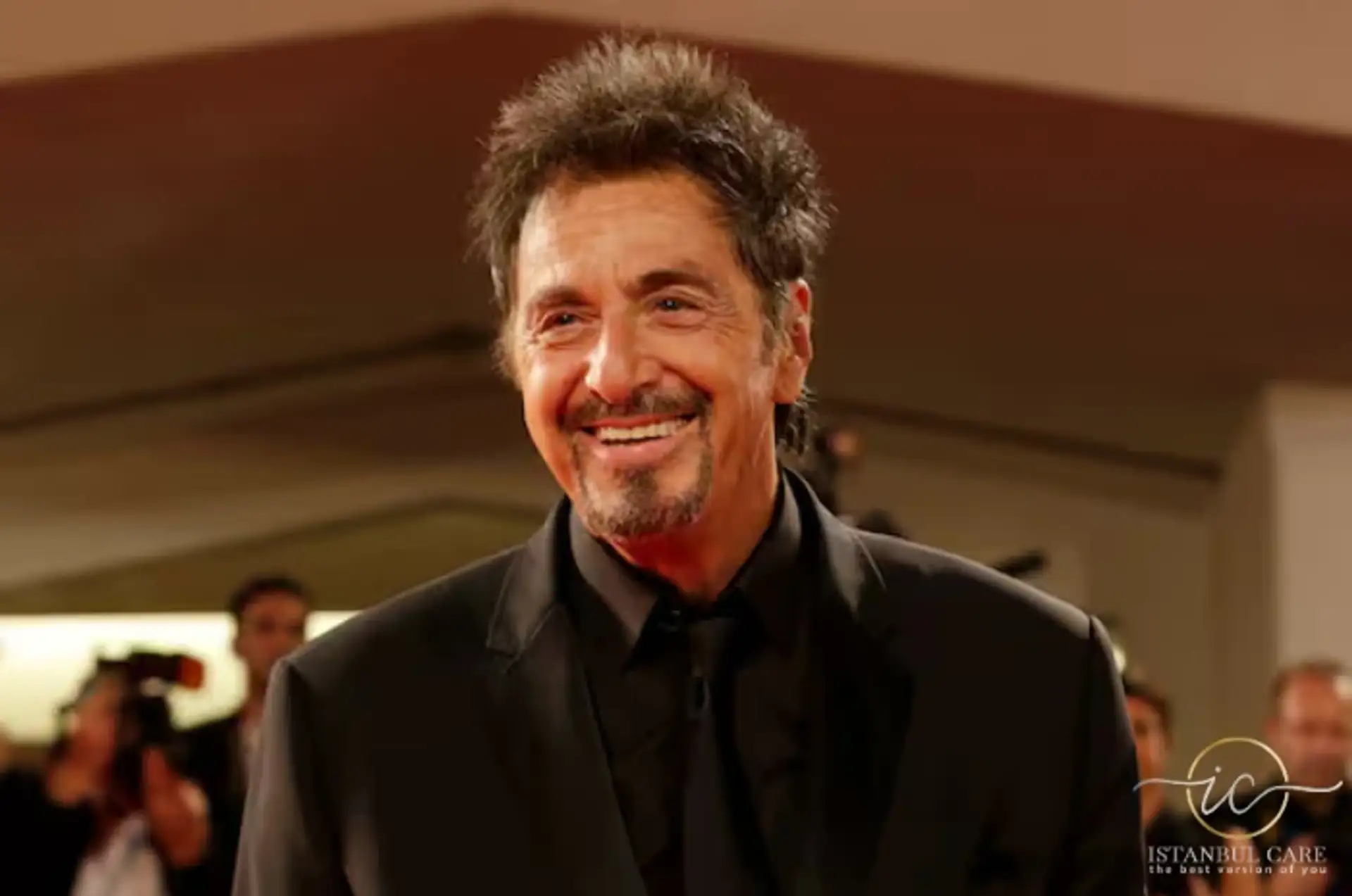 Transplanti i flokëve të Al Pacino-s në Turqi