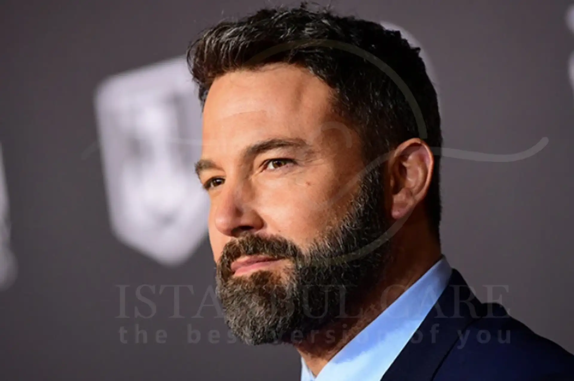 Ben Affleck's Hair Transplant