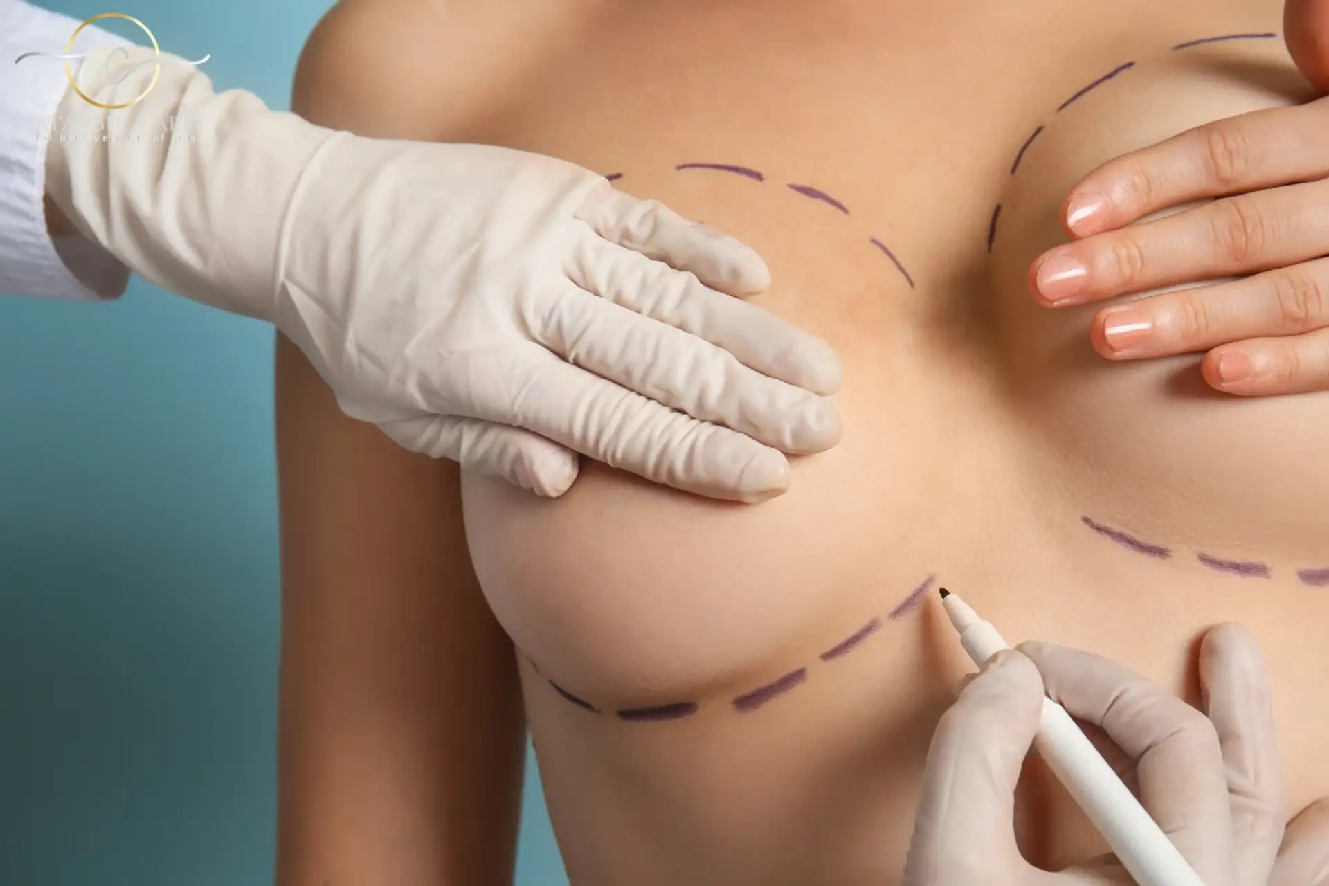 Breast Reduction in Turkey Price