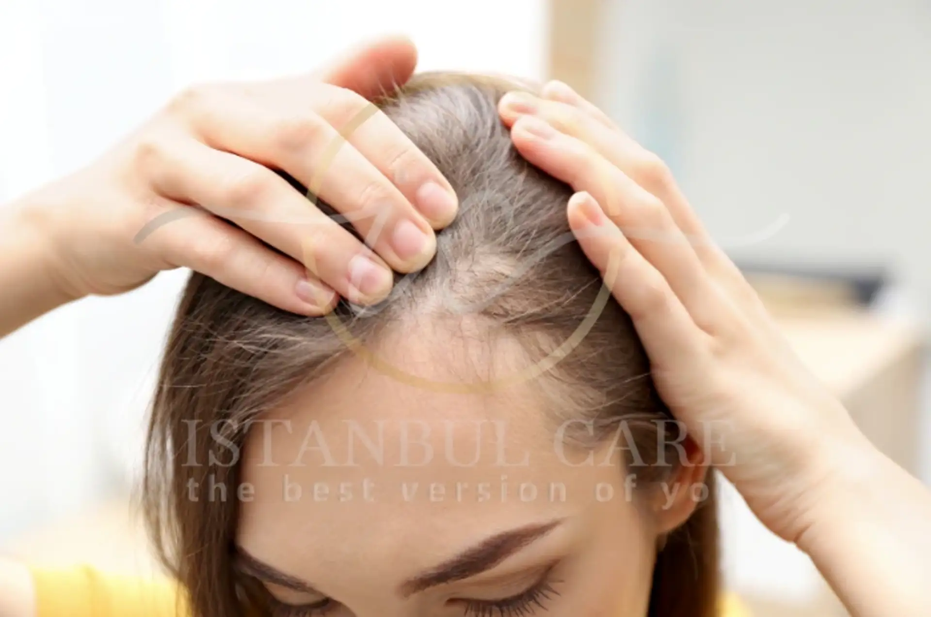 Dutasteride for Hair Loss