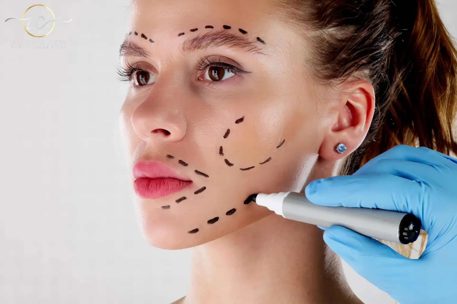 Facelift in Turkey