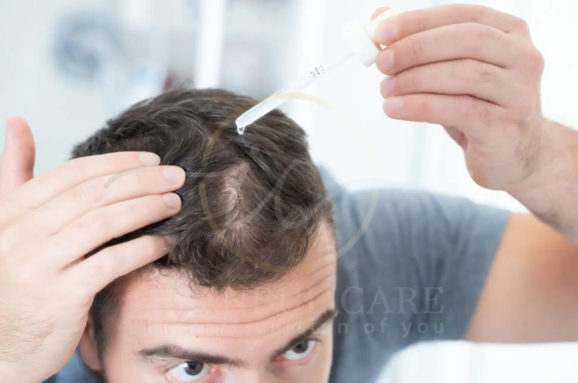 Finasteride Uses for Hair Loss