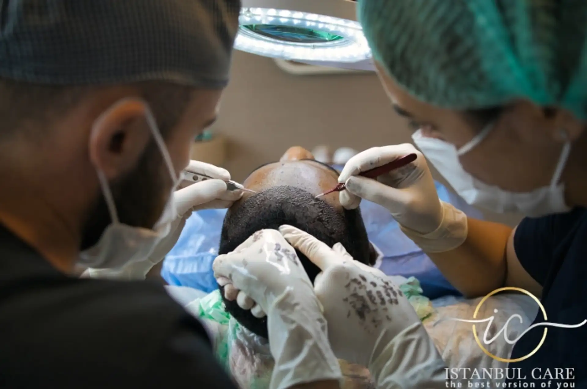 Hair Transplant Safe for HIV Patients