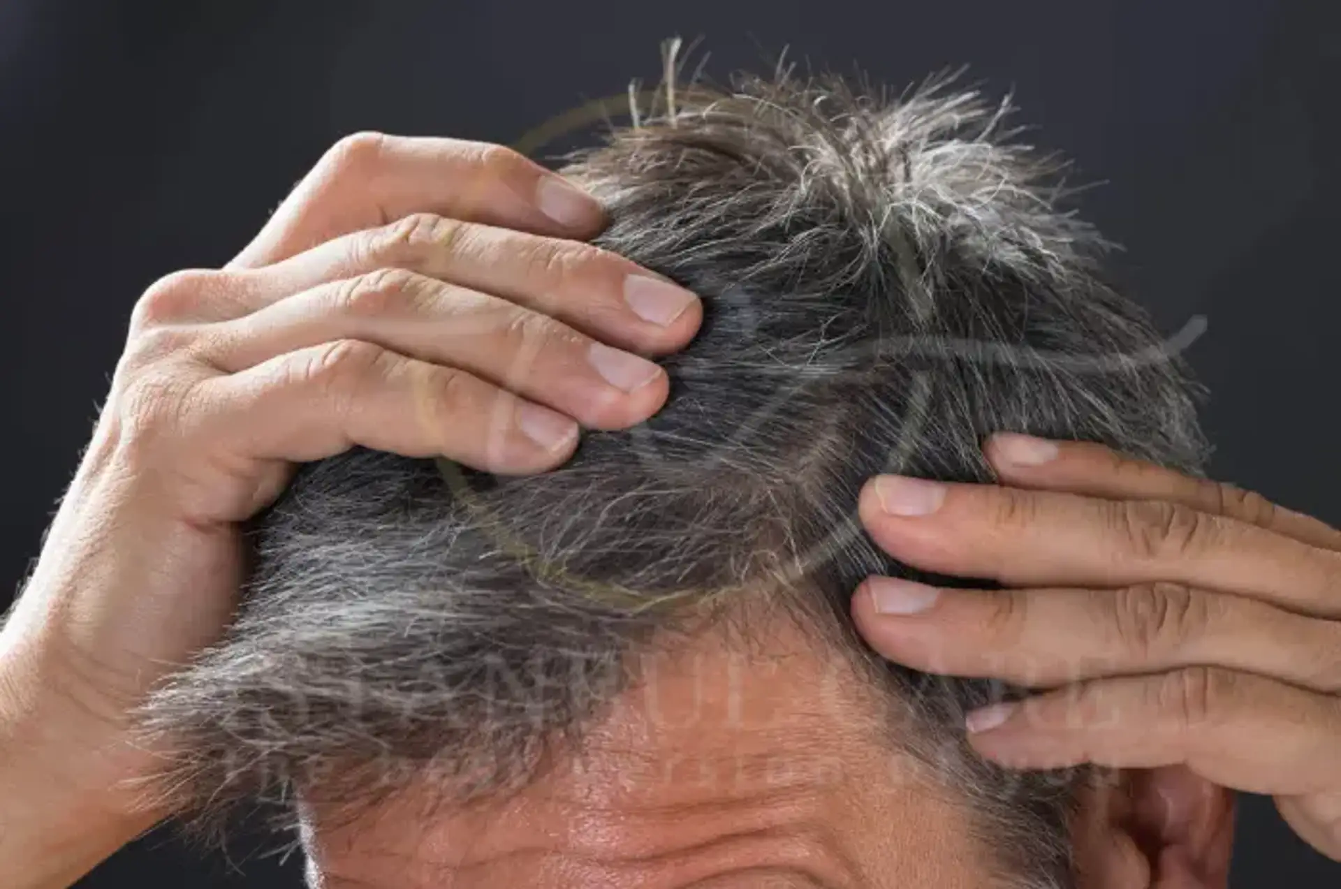 Why Does Hair Turn White