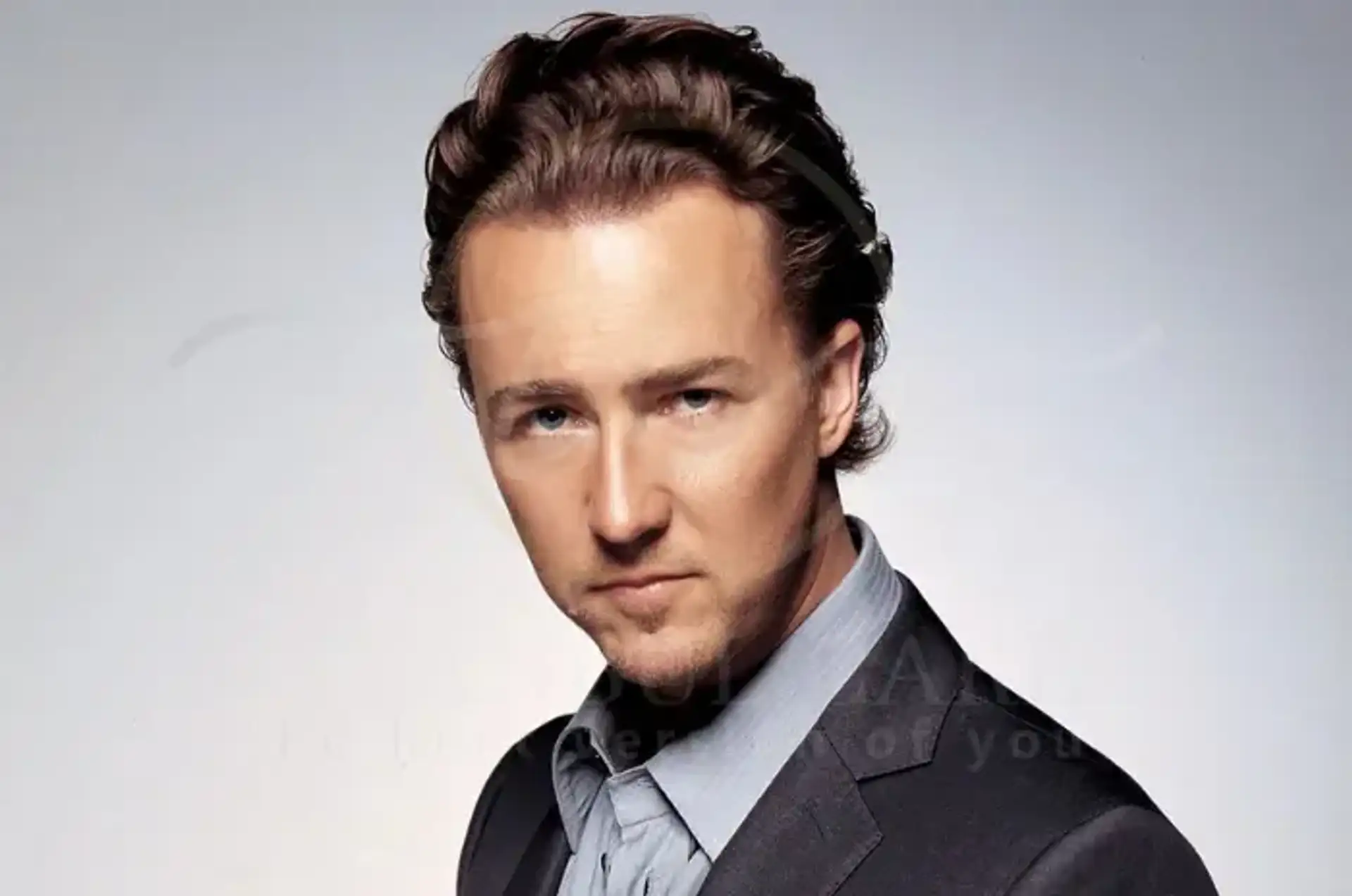 edward-nortos-hair-transplant-2