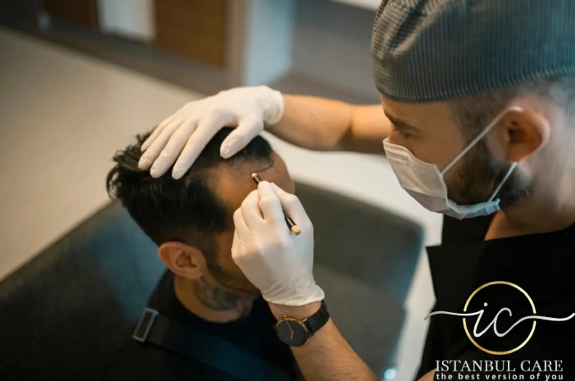 fue hair transplant in tirana