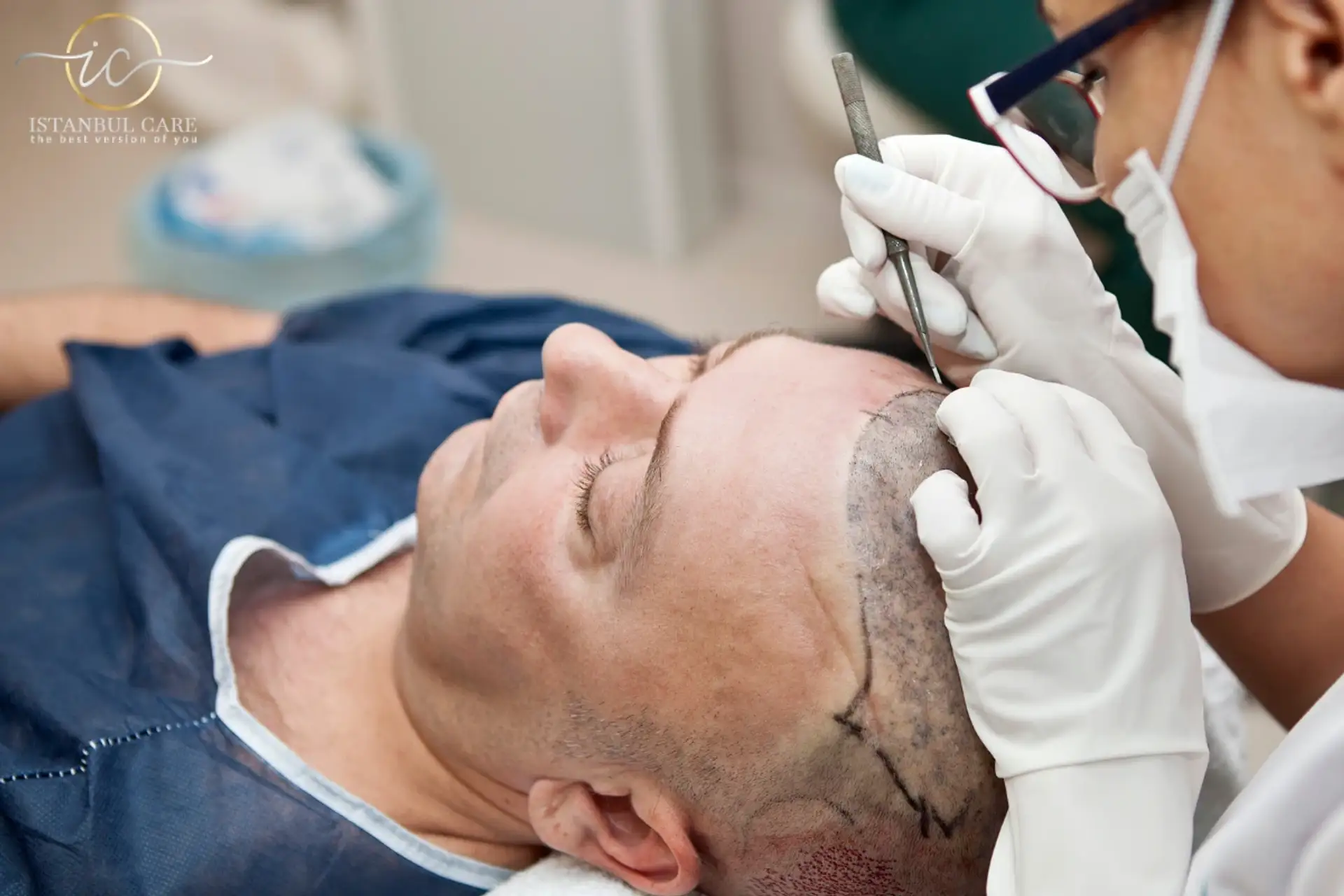 how much cost hair transplant in turkey