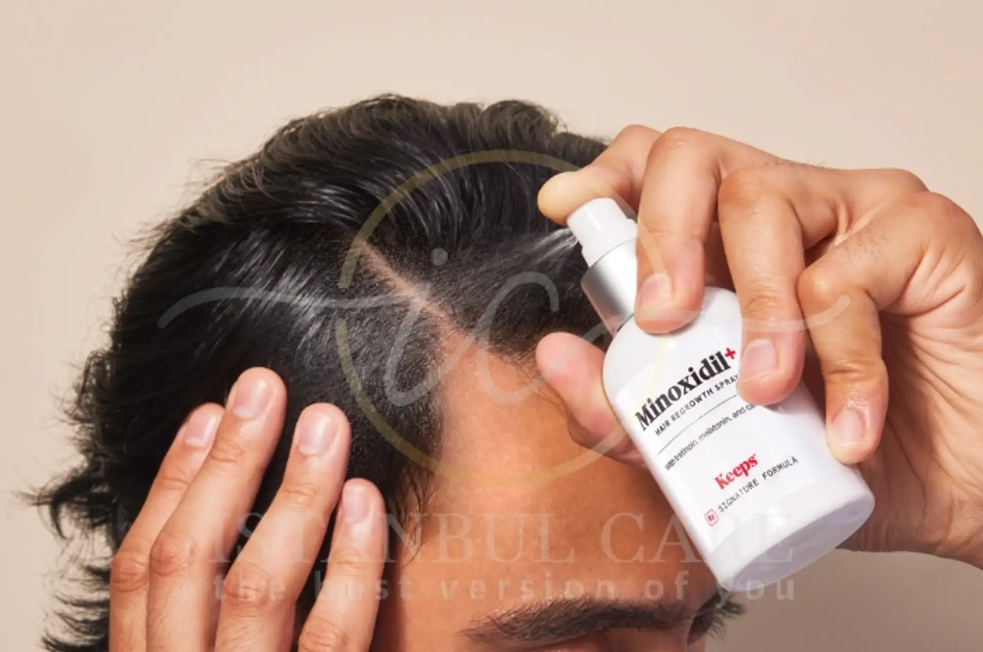 Minoxidil : un remède contre la perte de cheveux