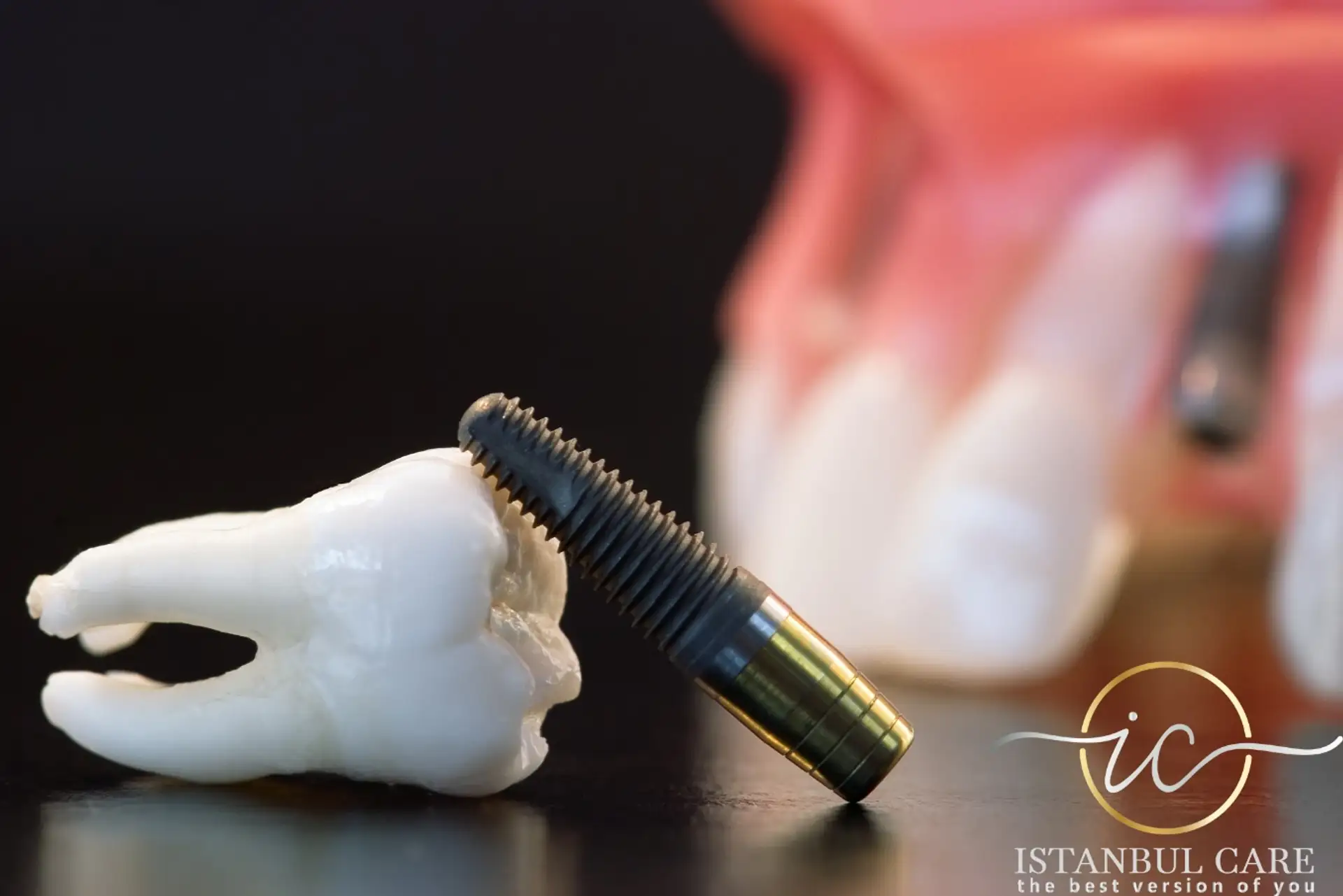 implant treatment