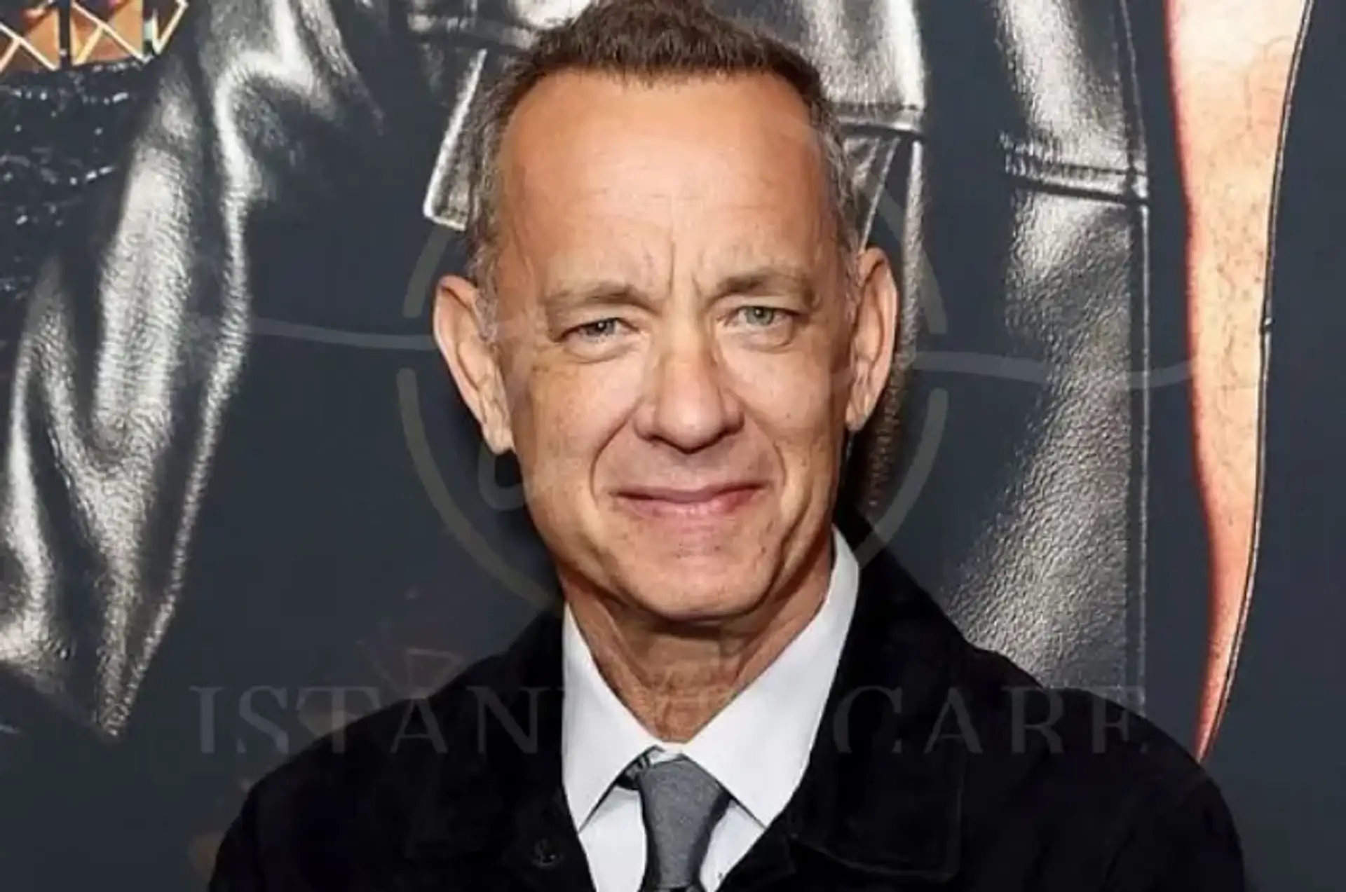 tom-hanks-hair-transplant