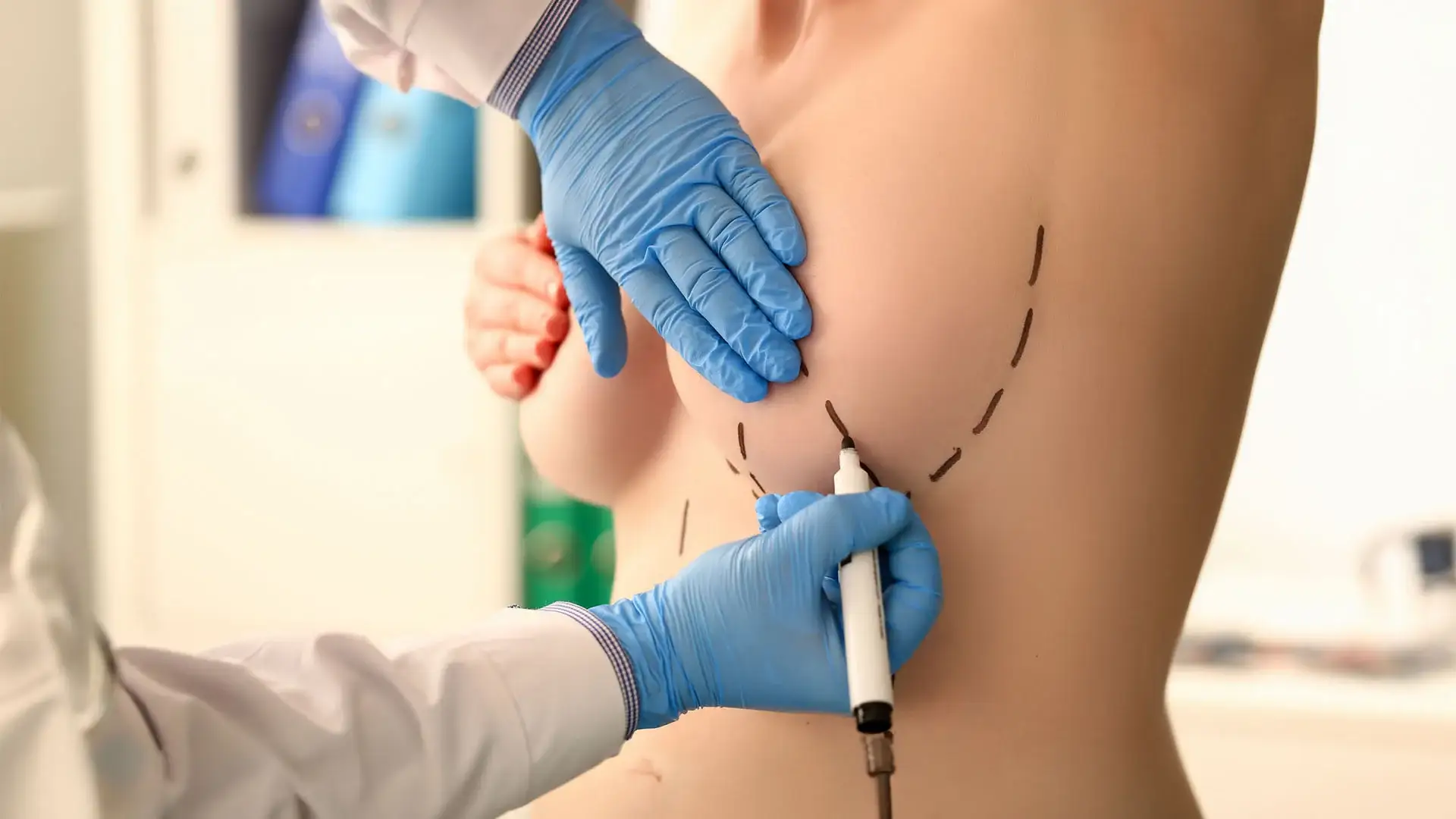Breast Reduction in Istanbul Care