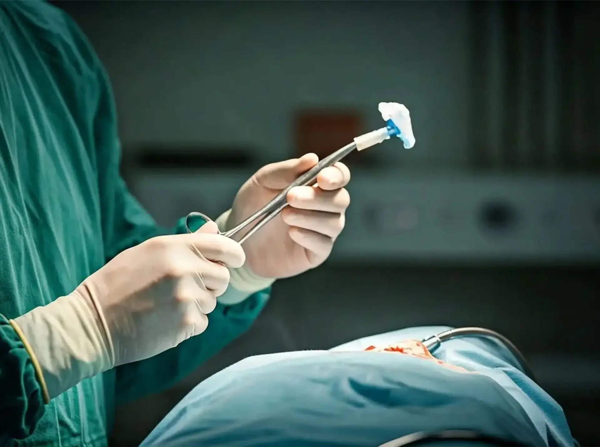 Am I a Candidate for Sleeve Gastrectomy Surgery?