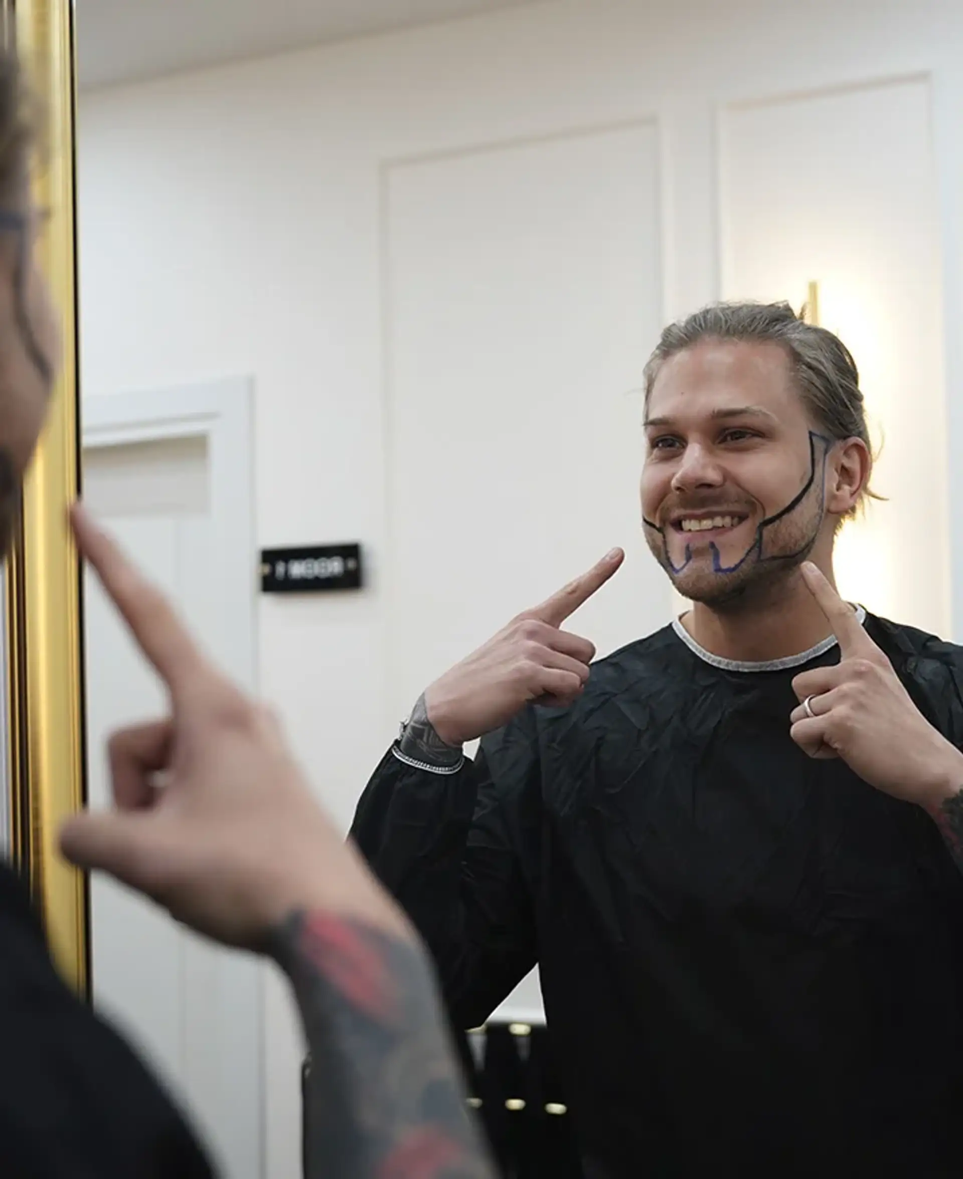 Beard Hair Transplant Technique