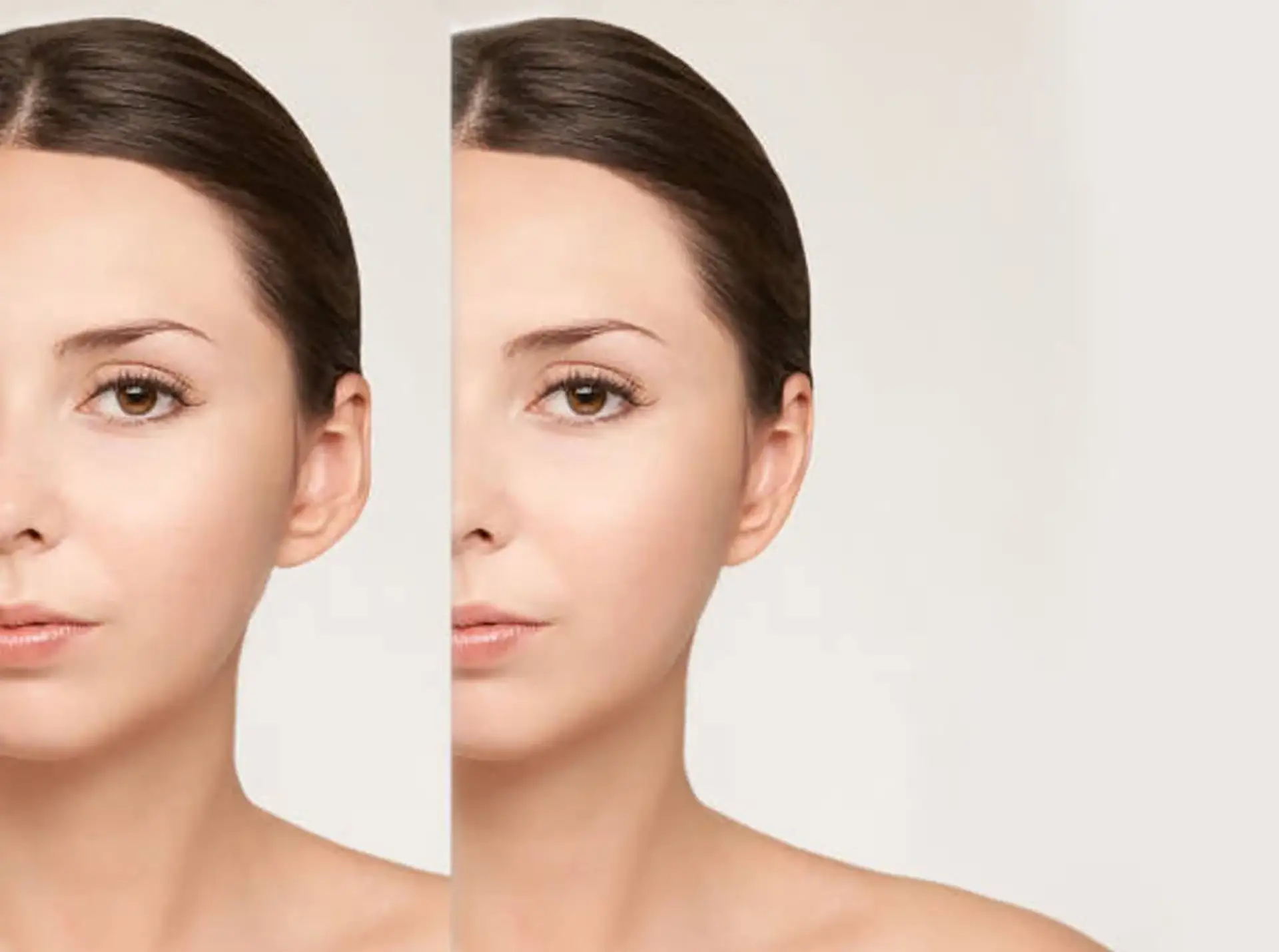 Ear Reshaping in Istanbul care