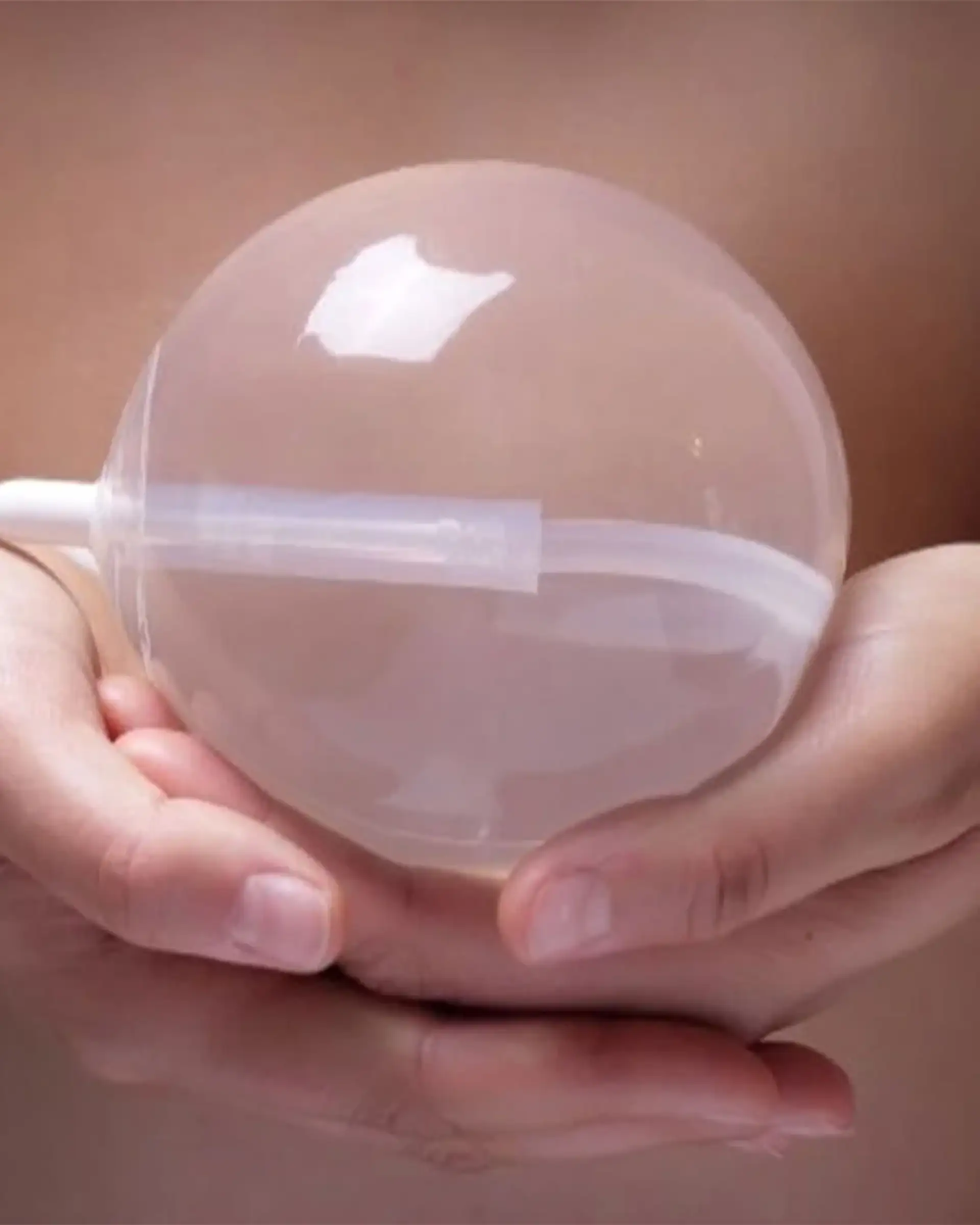 How Is the Gastric Balloon Inserted?