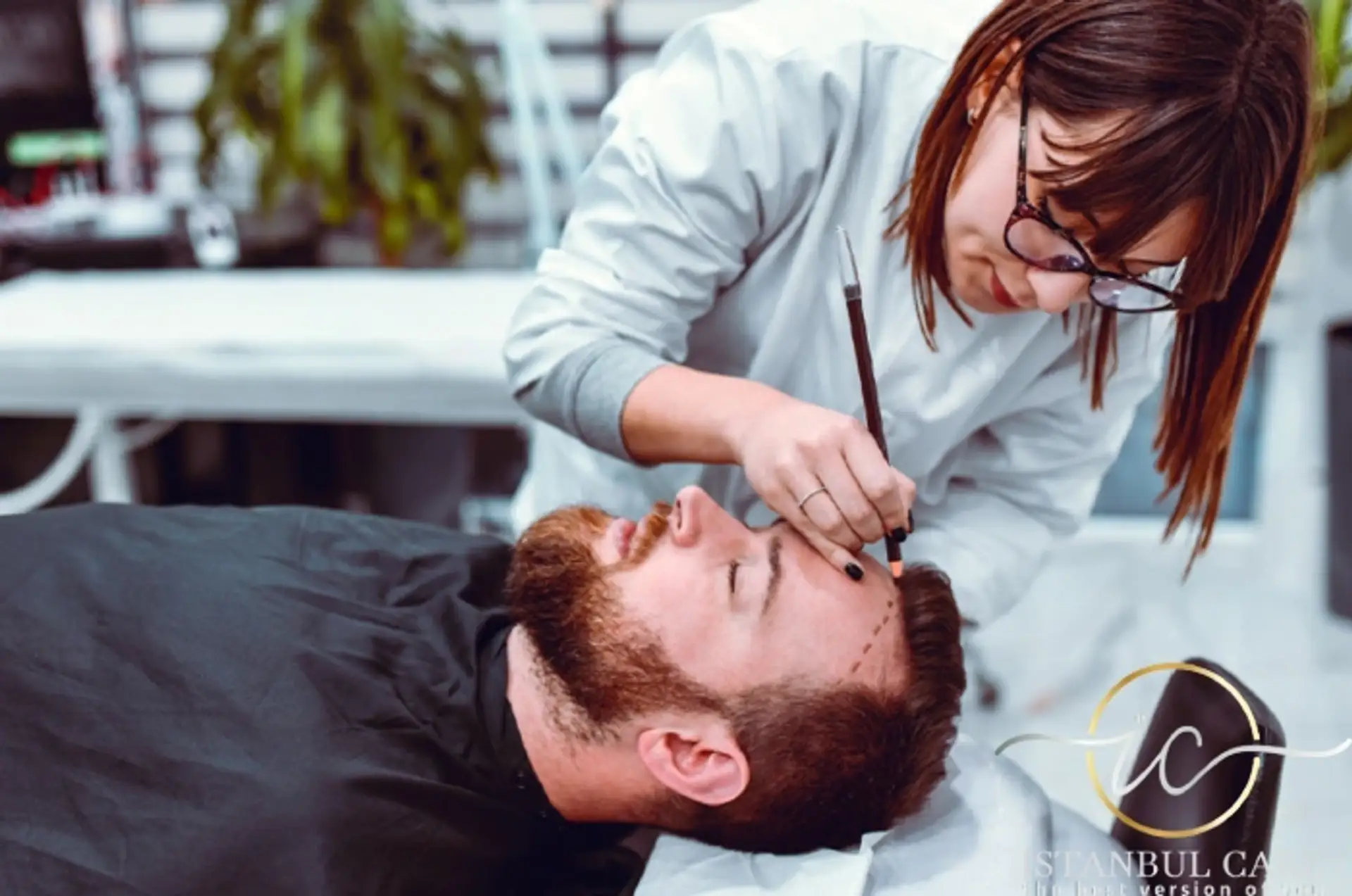 Técnicas de transplante capilar em Istambul