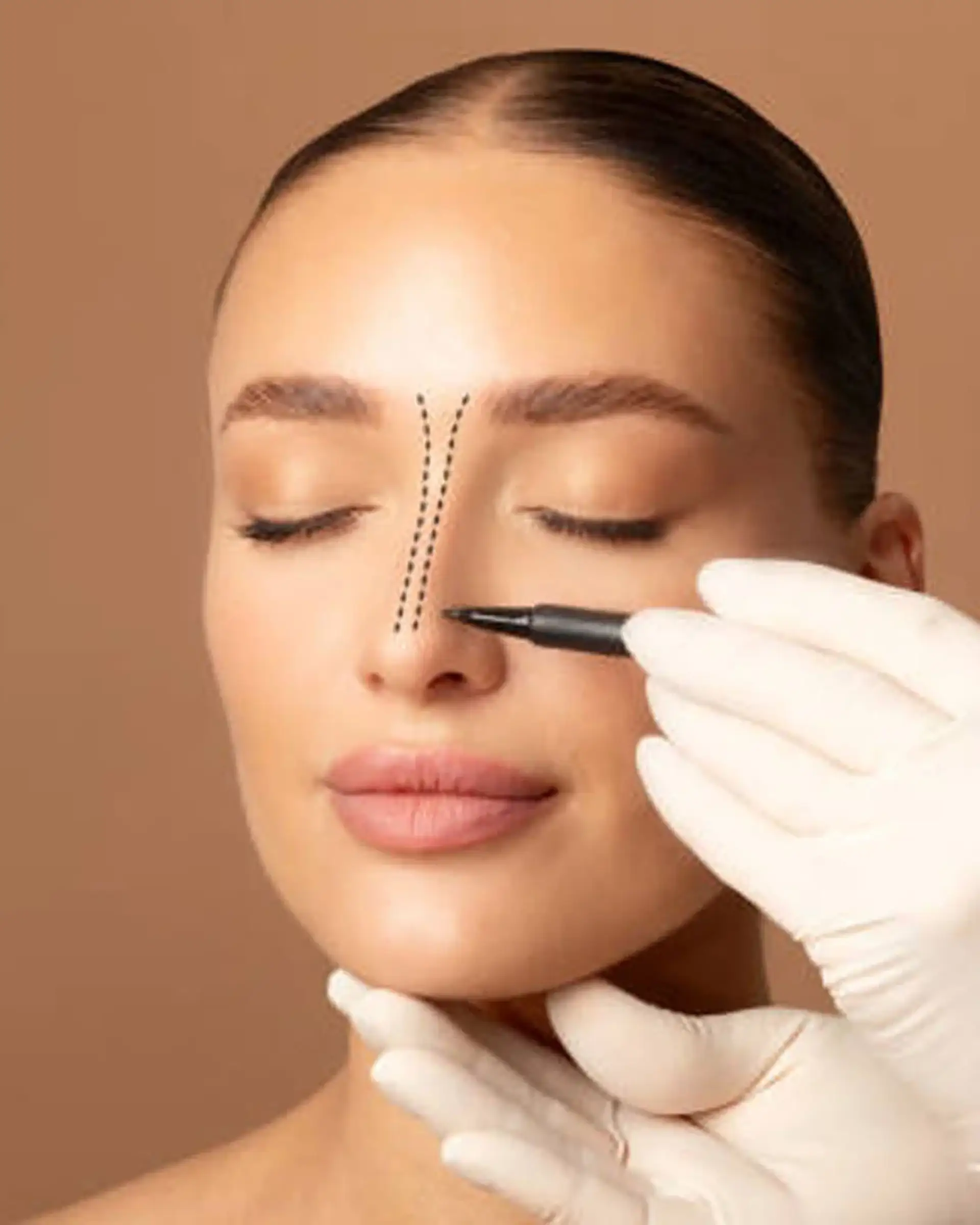 Open and Closed Rhinoplasty Techniques