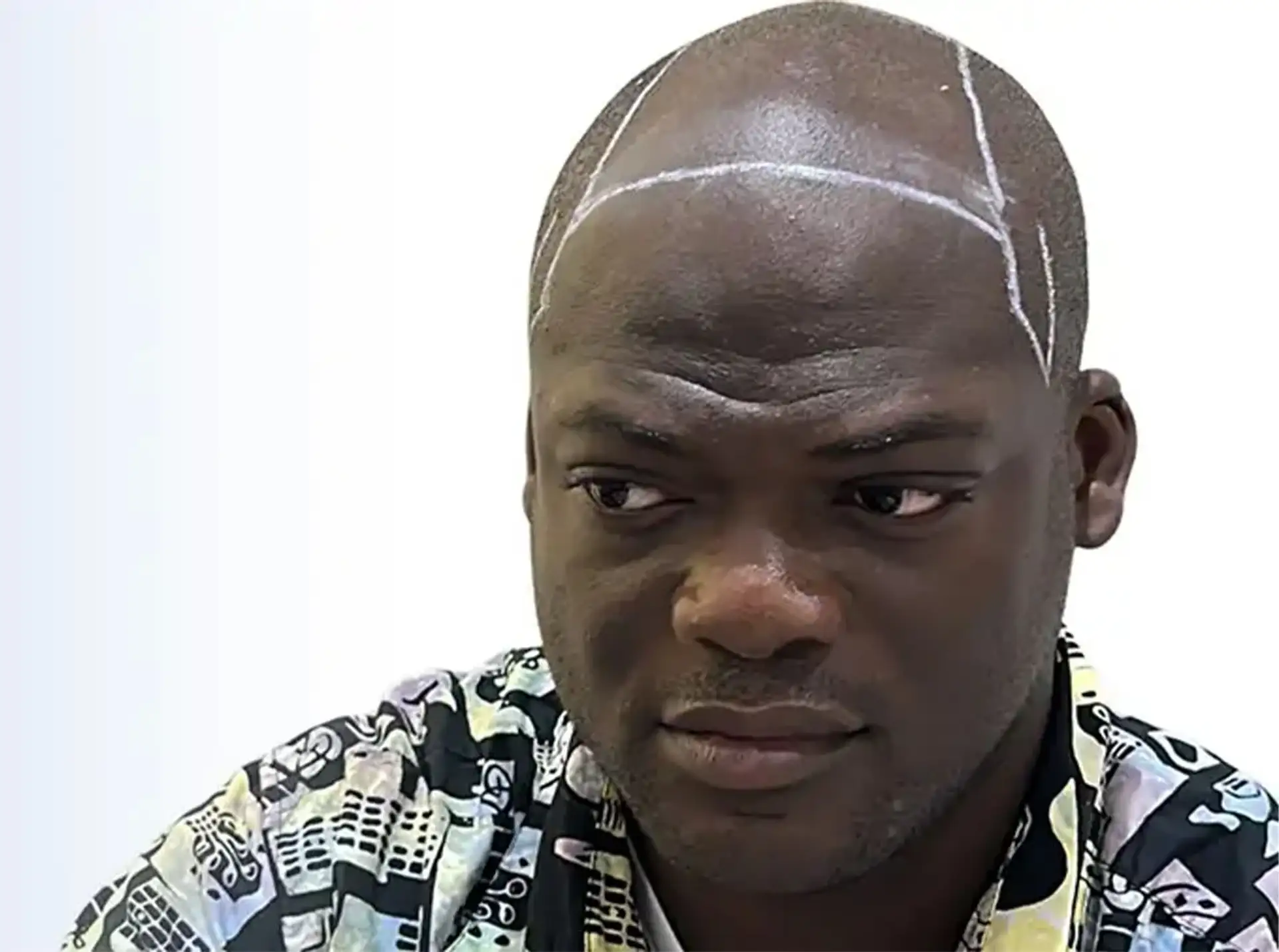 Man with a closely shaved head and a hairline outline drawn in white pencil across his forehead, photographed against a white wall.