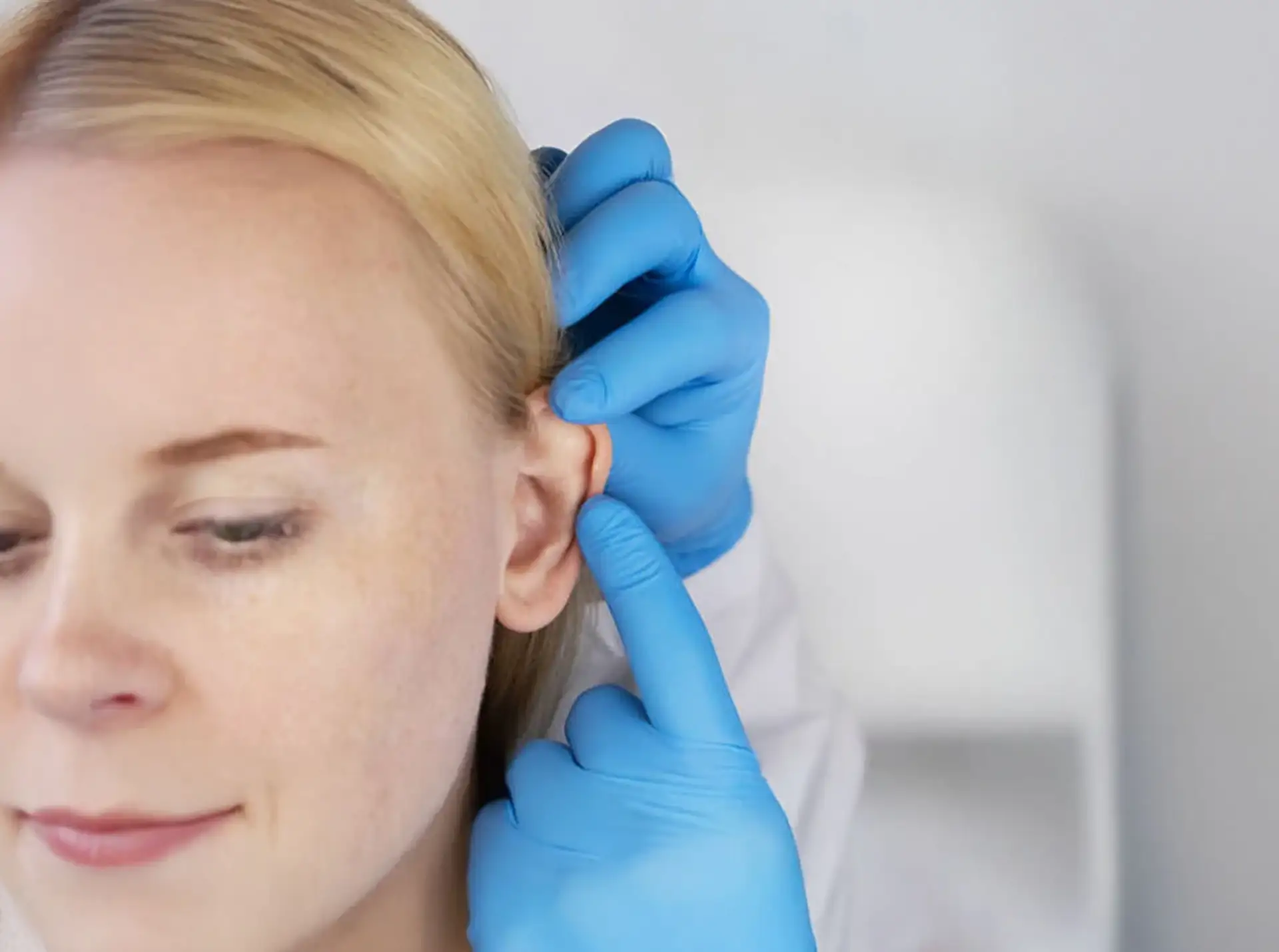 What Is Otoplasty?