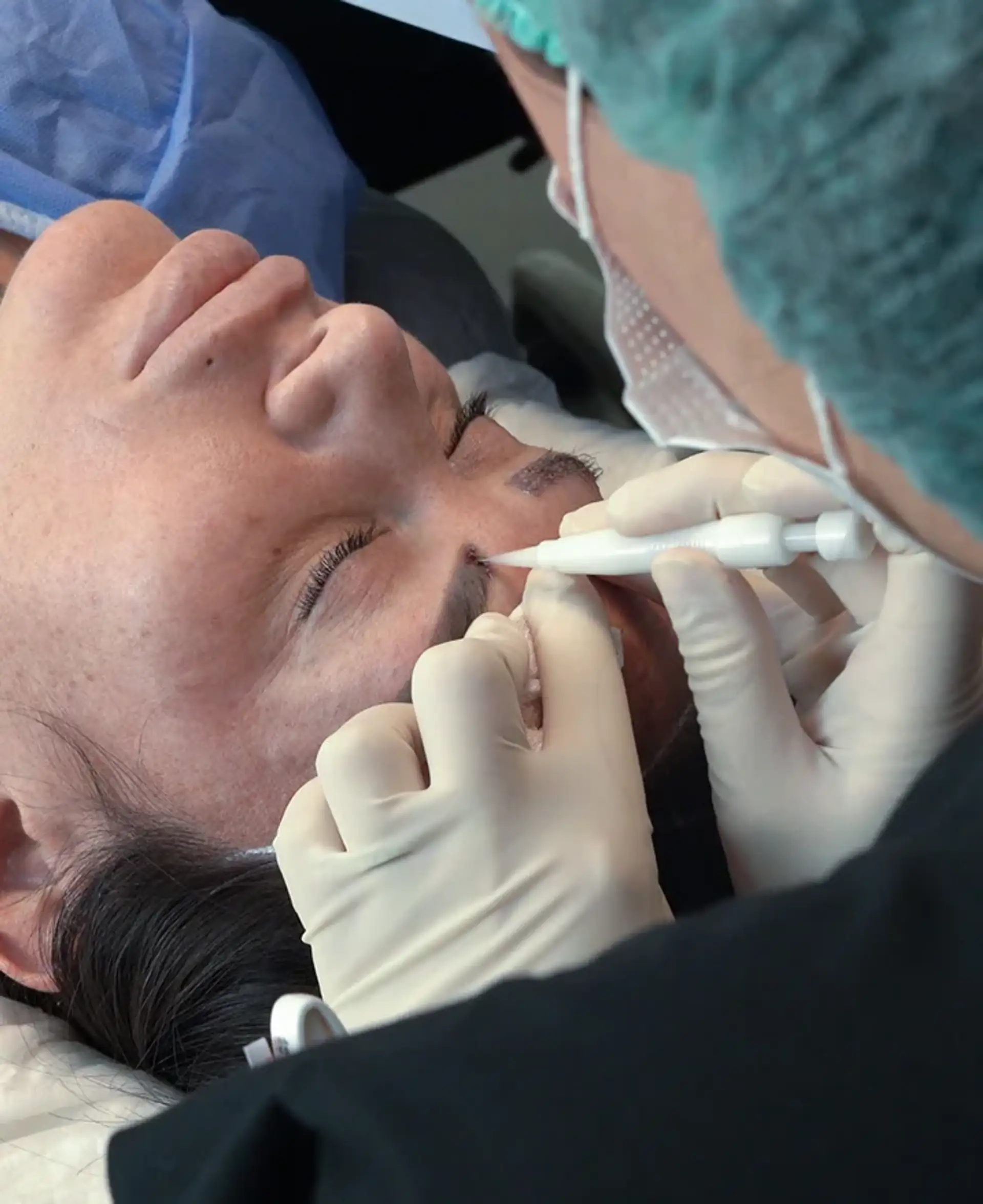 Quando a cirurgia de transplante de sobrancelha não é recomendada