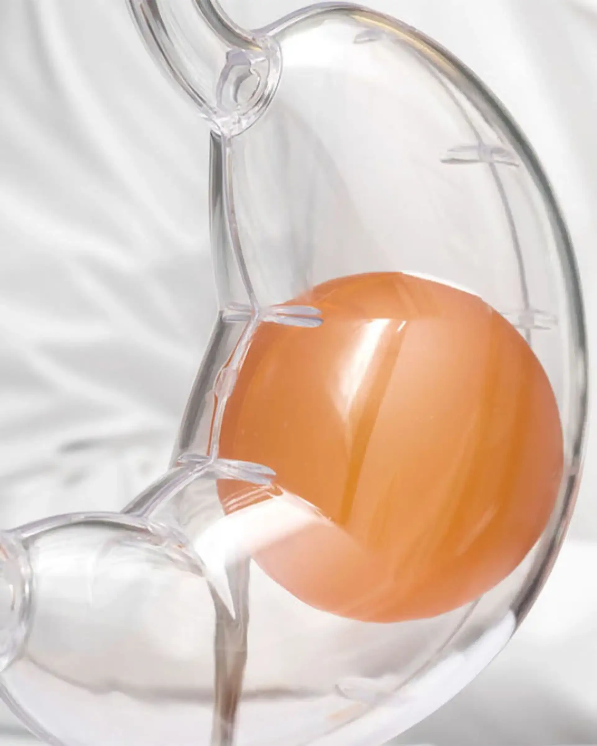 Who Is a Candidate for the Gastric Balloon?