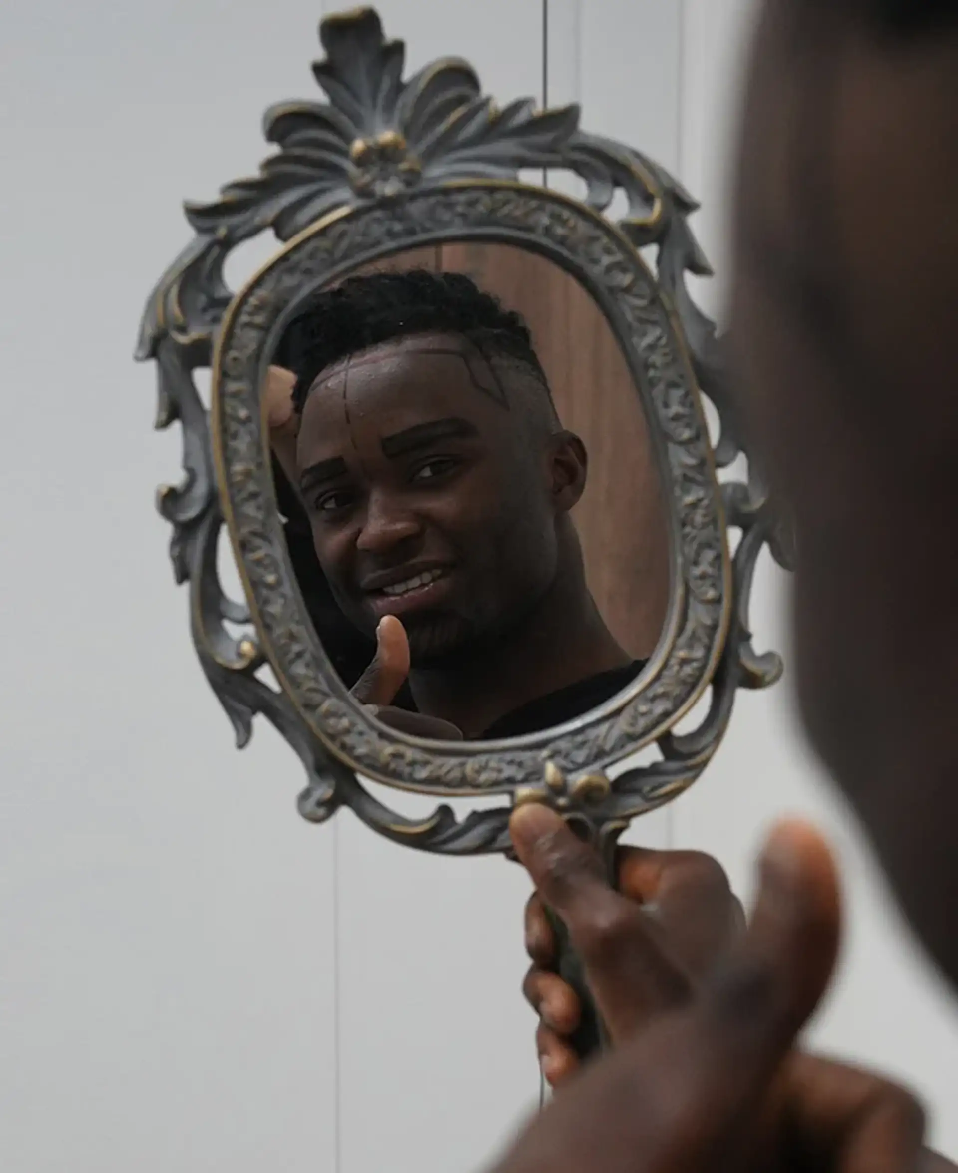 Afro-Haartransplantation in der Türkei