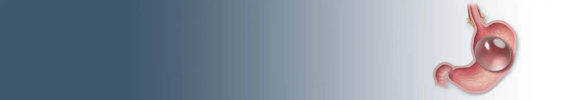 Gastric Balloon in Turkey