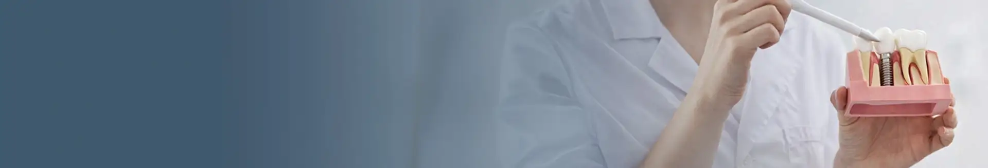 Leczenie implantami w Turcji