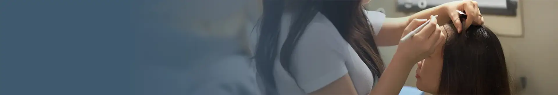 Women Hair Transplant