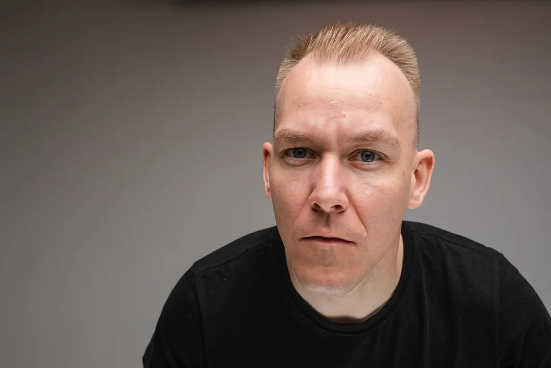 Przeszczep włosów blond