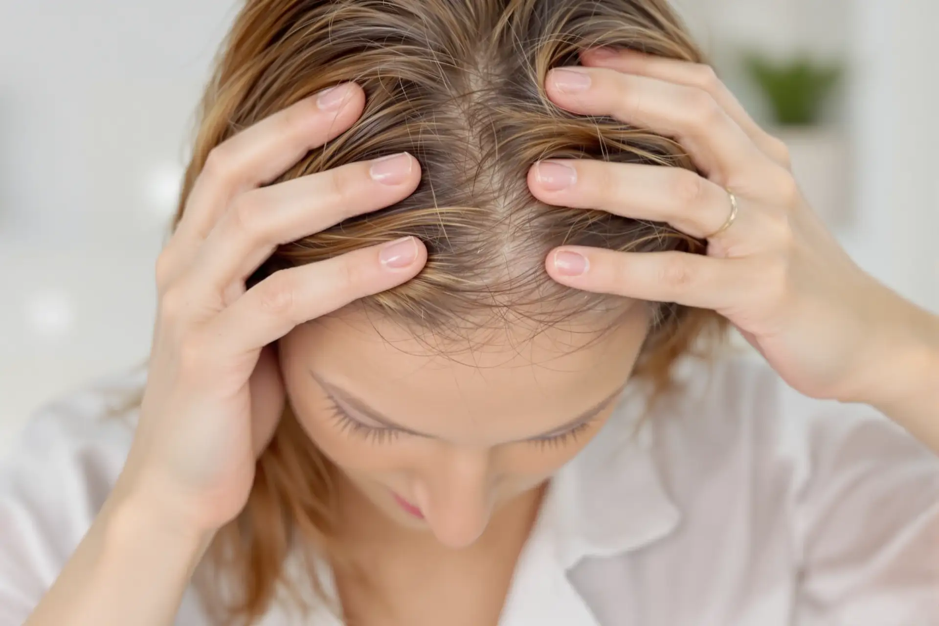 Cause, sintomi e trattamenti della perdita di capelli con dolore al cuoio capelluto