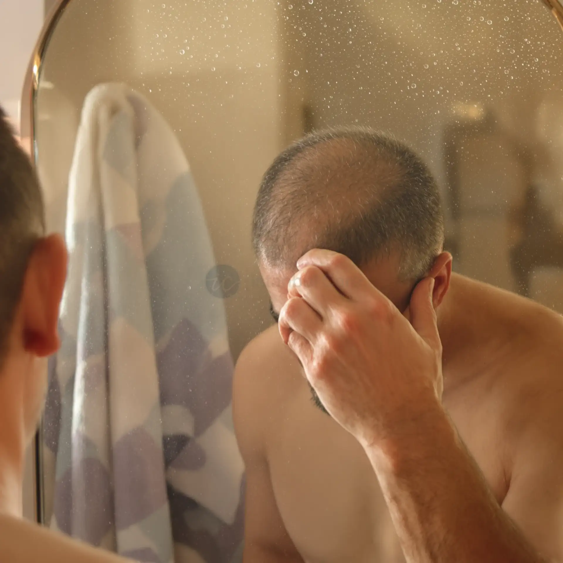 Quanti innesti per un trapianto di capelli – procedura.
