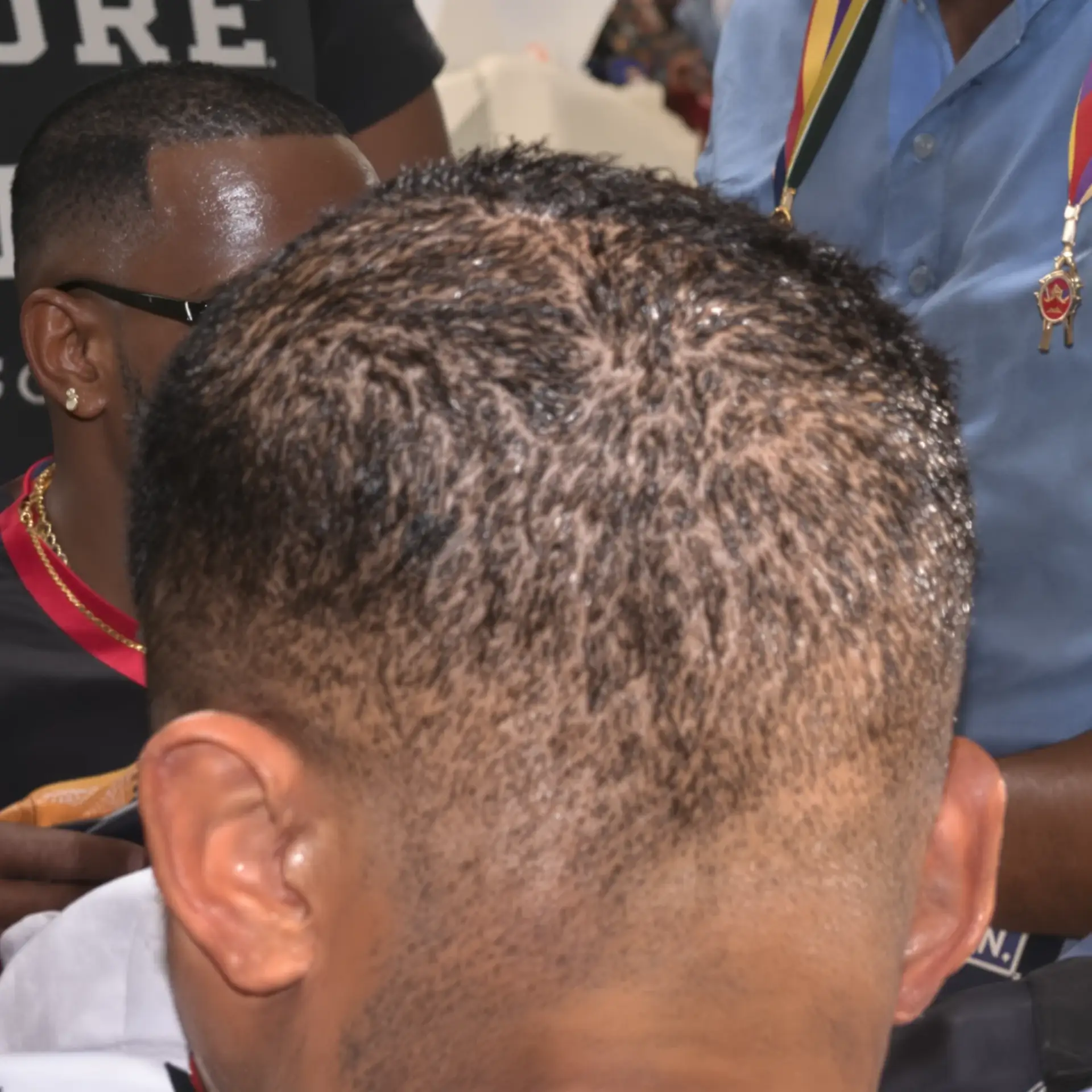 L'attaccatura di LeBron James: analisi della perdita di capelli di una celebrità.